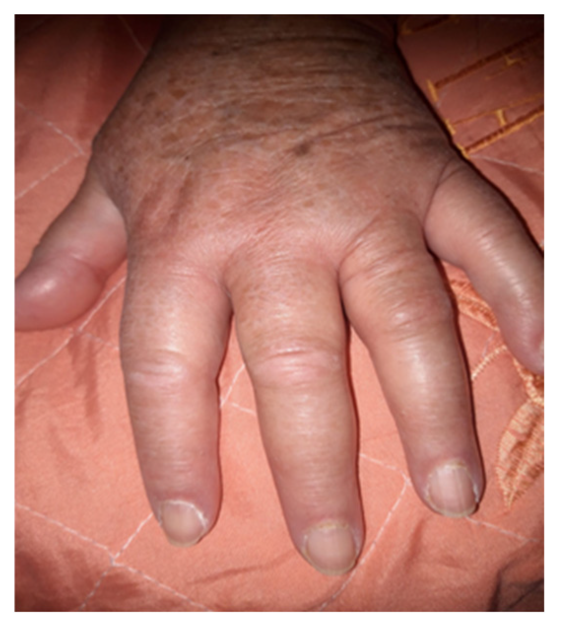 Medicina 60 01756 g002