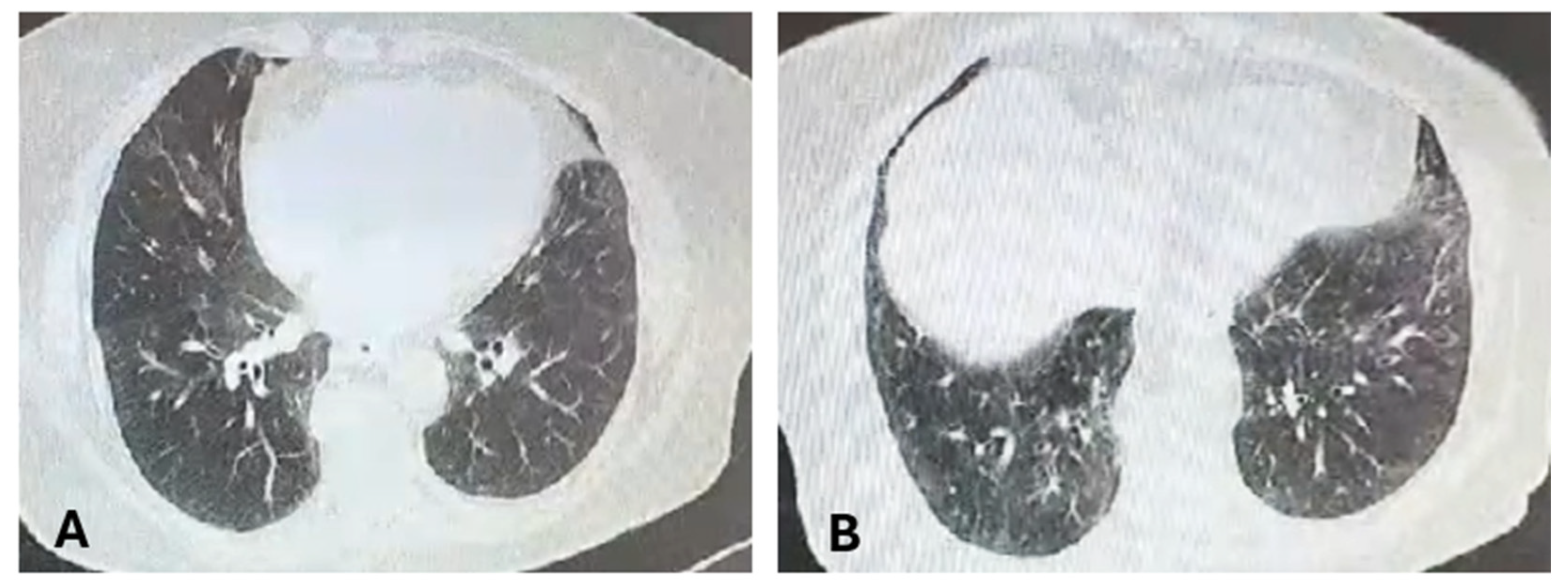 Medicina 60 01756 g003