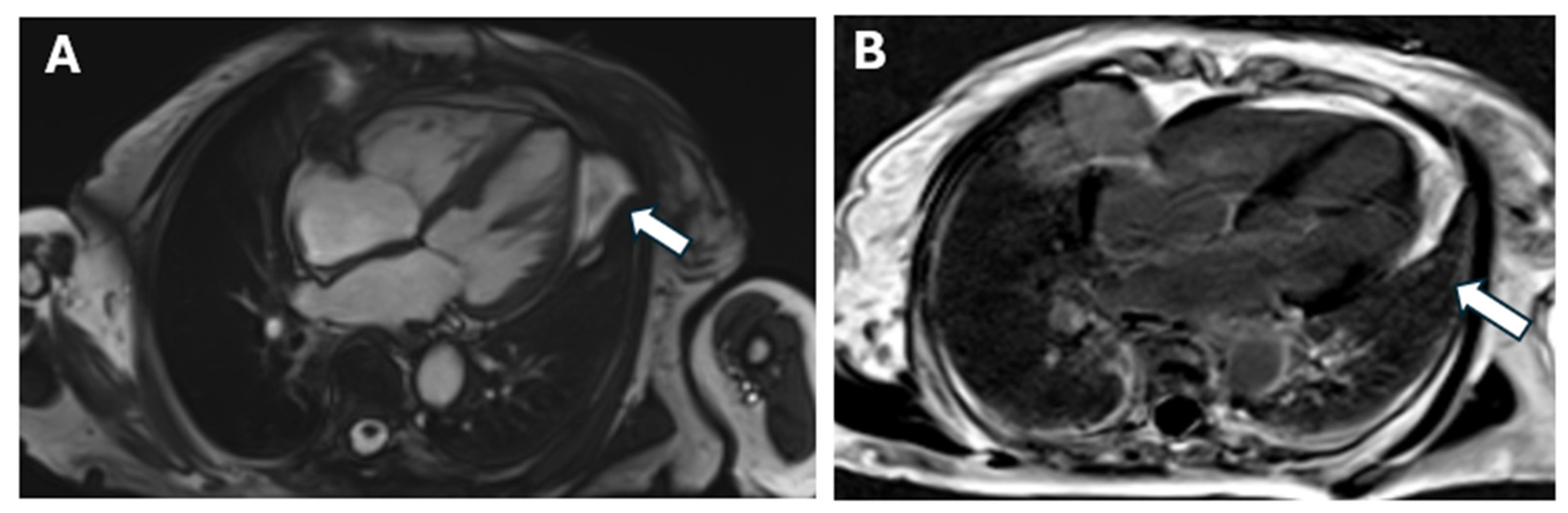 Medicina 60 01756 g005