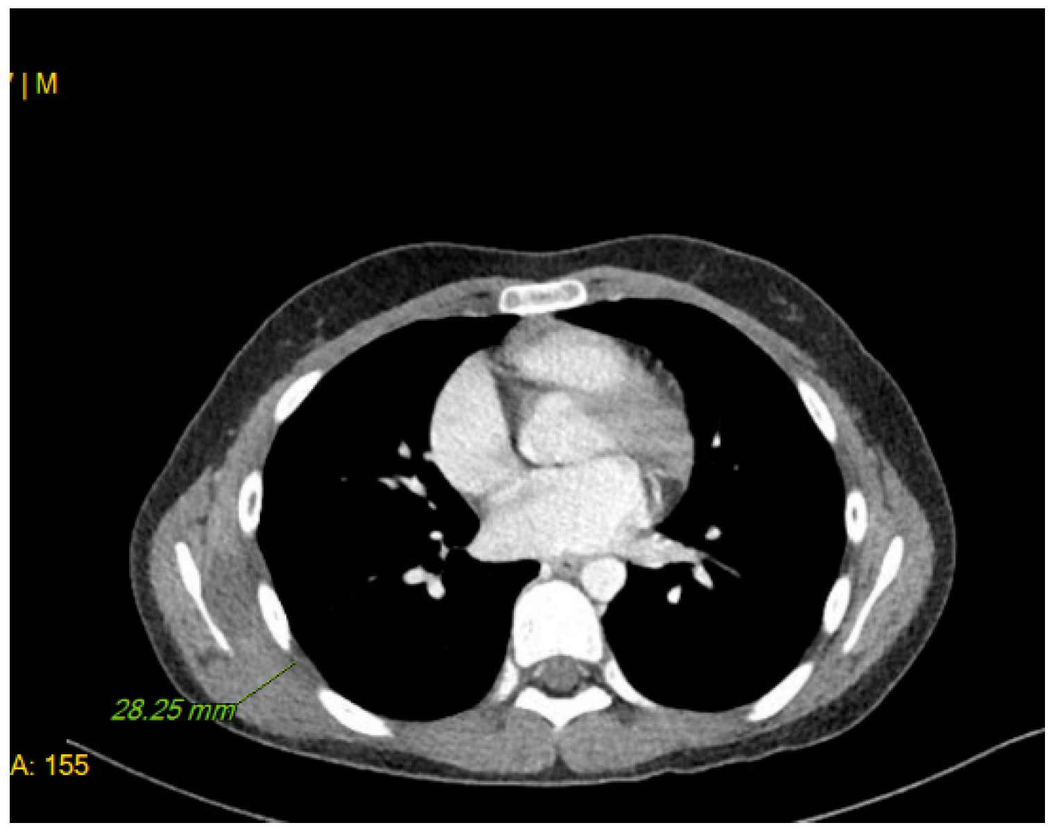 Medicina 60 01762 g002