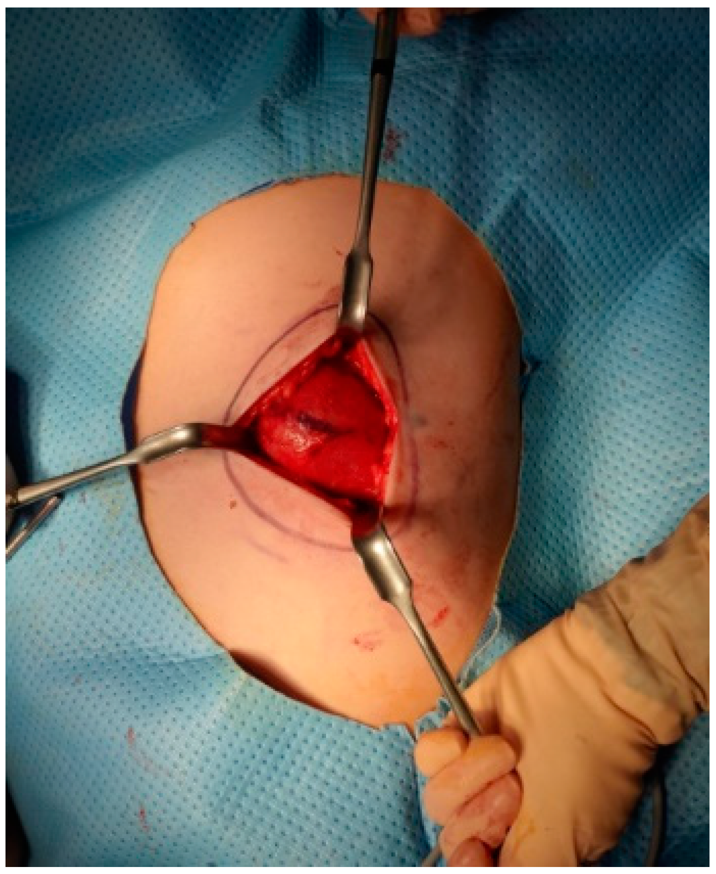 Medicina 60 01762 g003