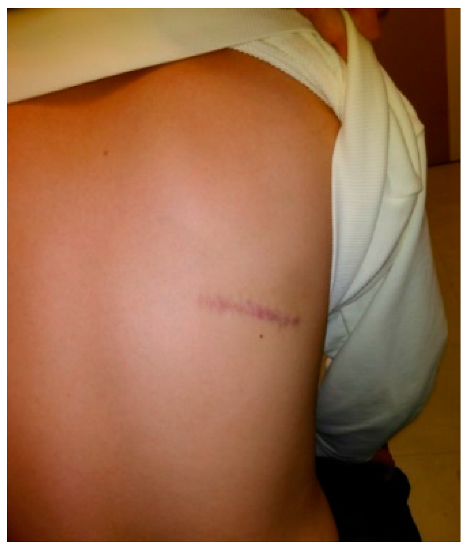 Medicina 60 01762 g005