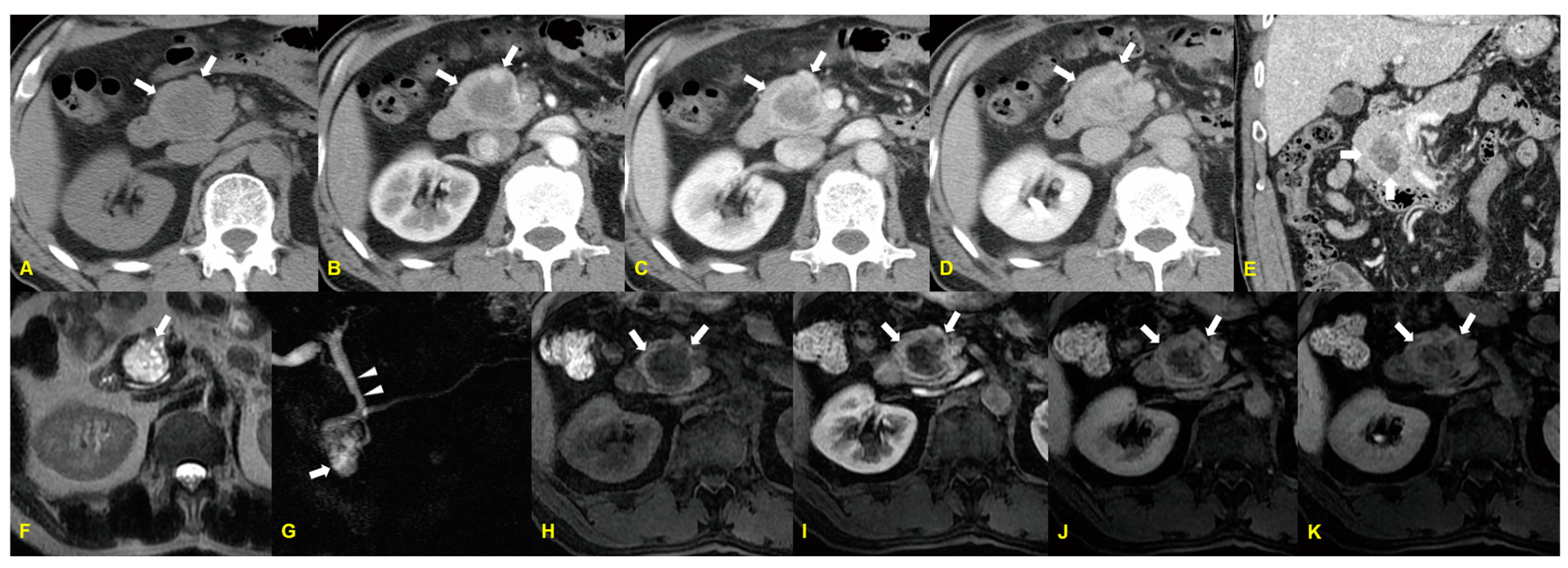Medicina 60 01766 g001