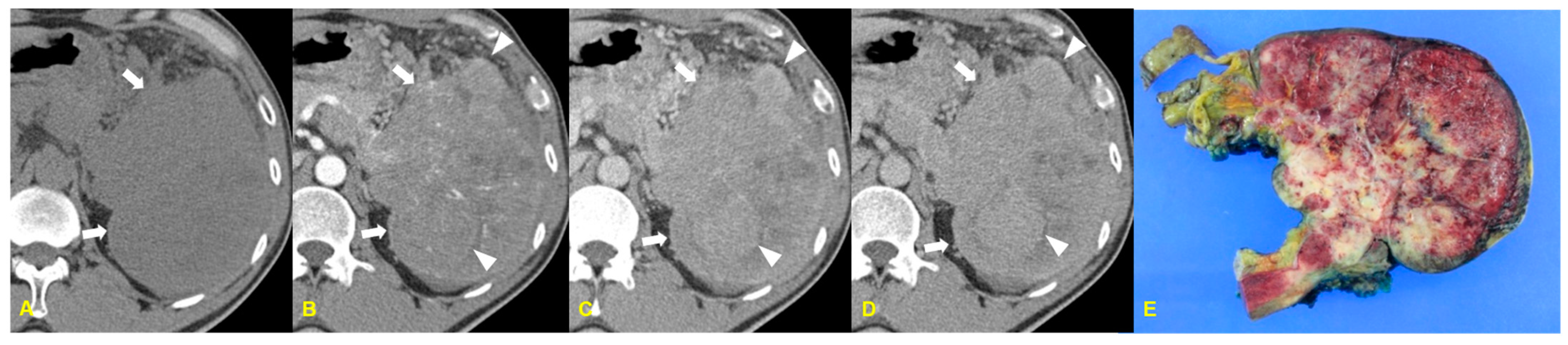 Medicina 60 01766 g002