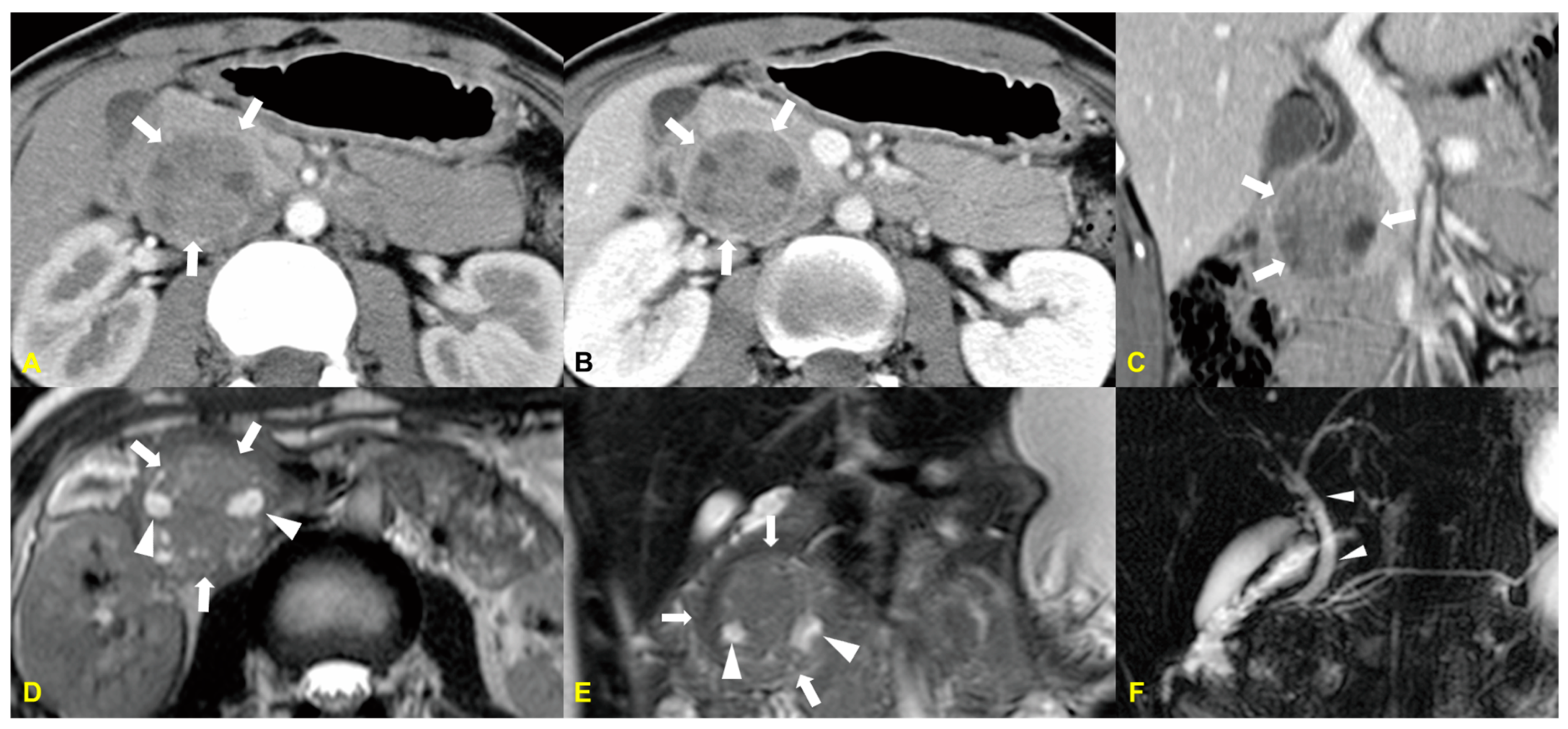 Medicina 60 01766 g003