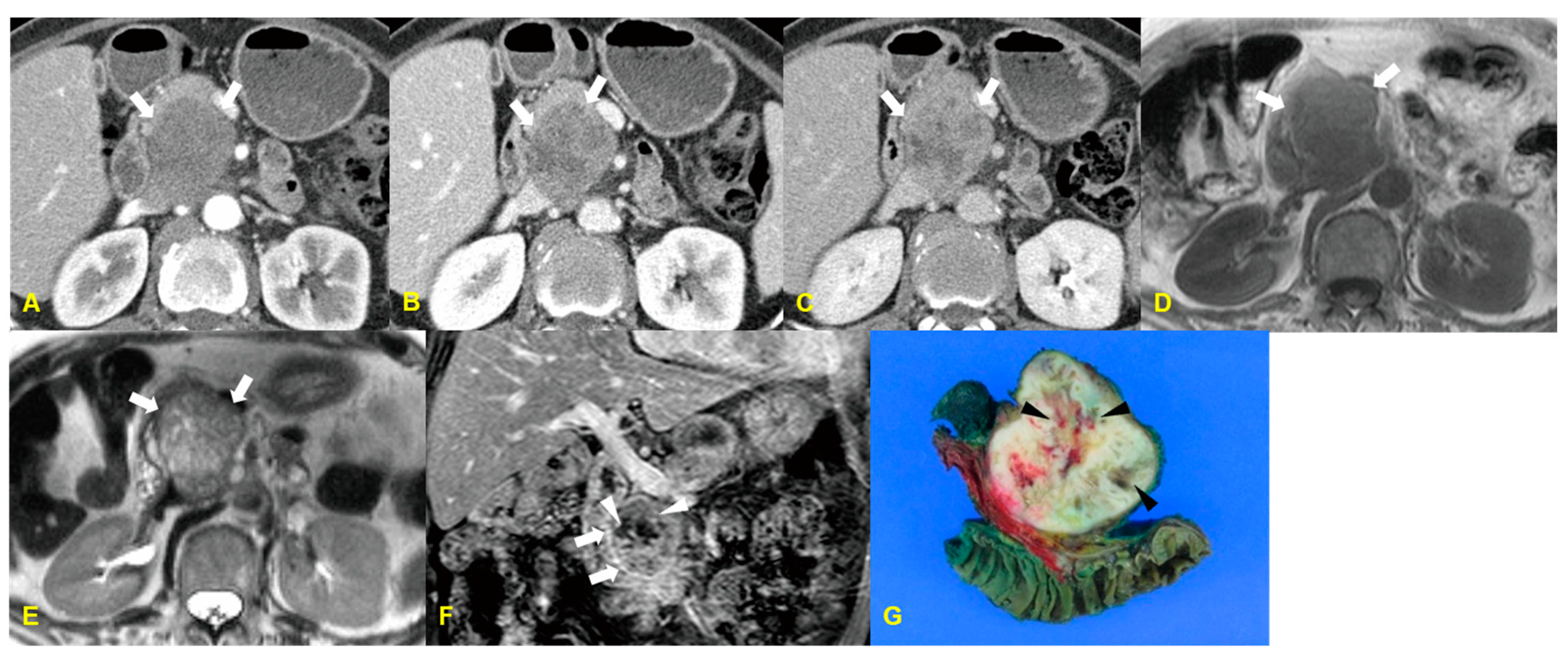 Medicina 60 01766 g004