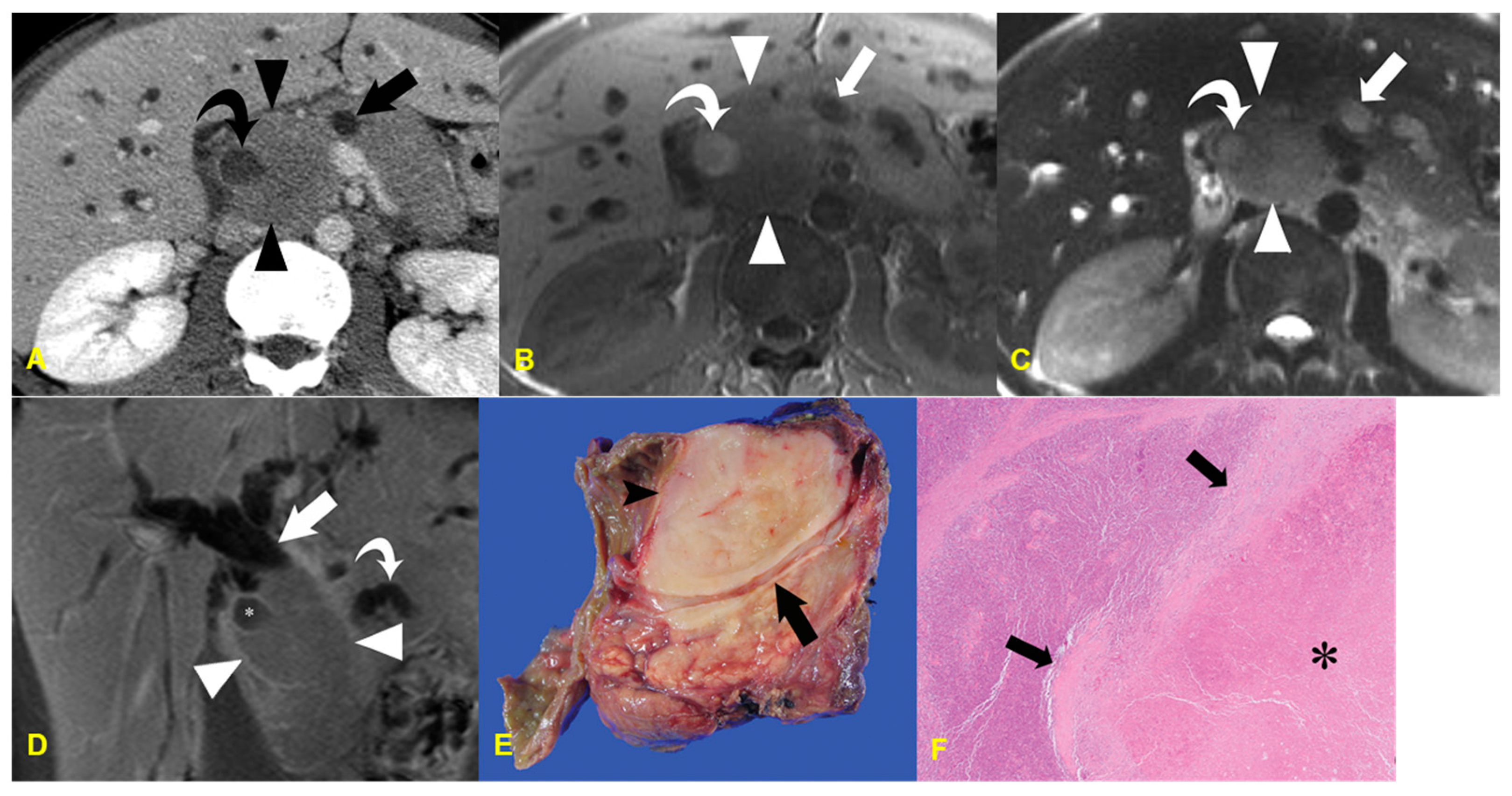 Medicina 60 01766 g005
