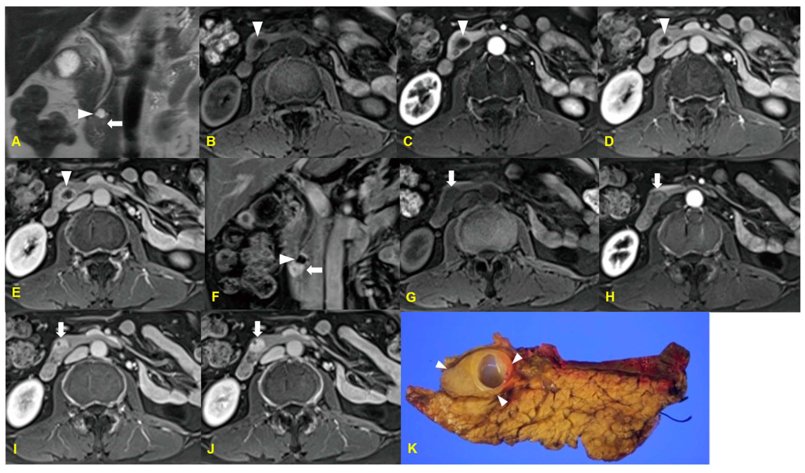 Medicina 60 01766 g006