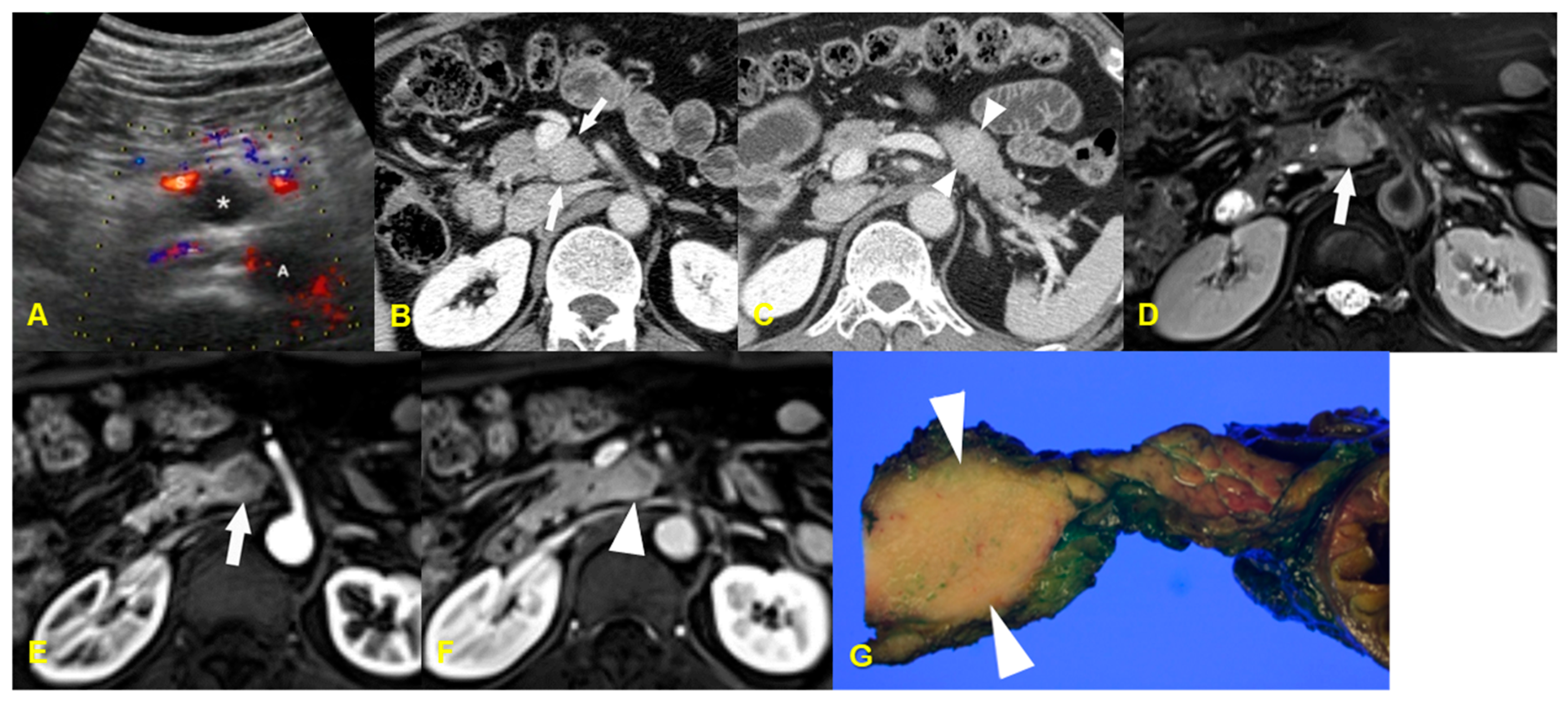Medicina 60 01766 g007