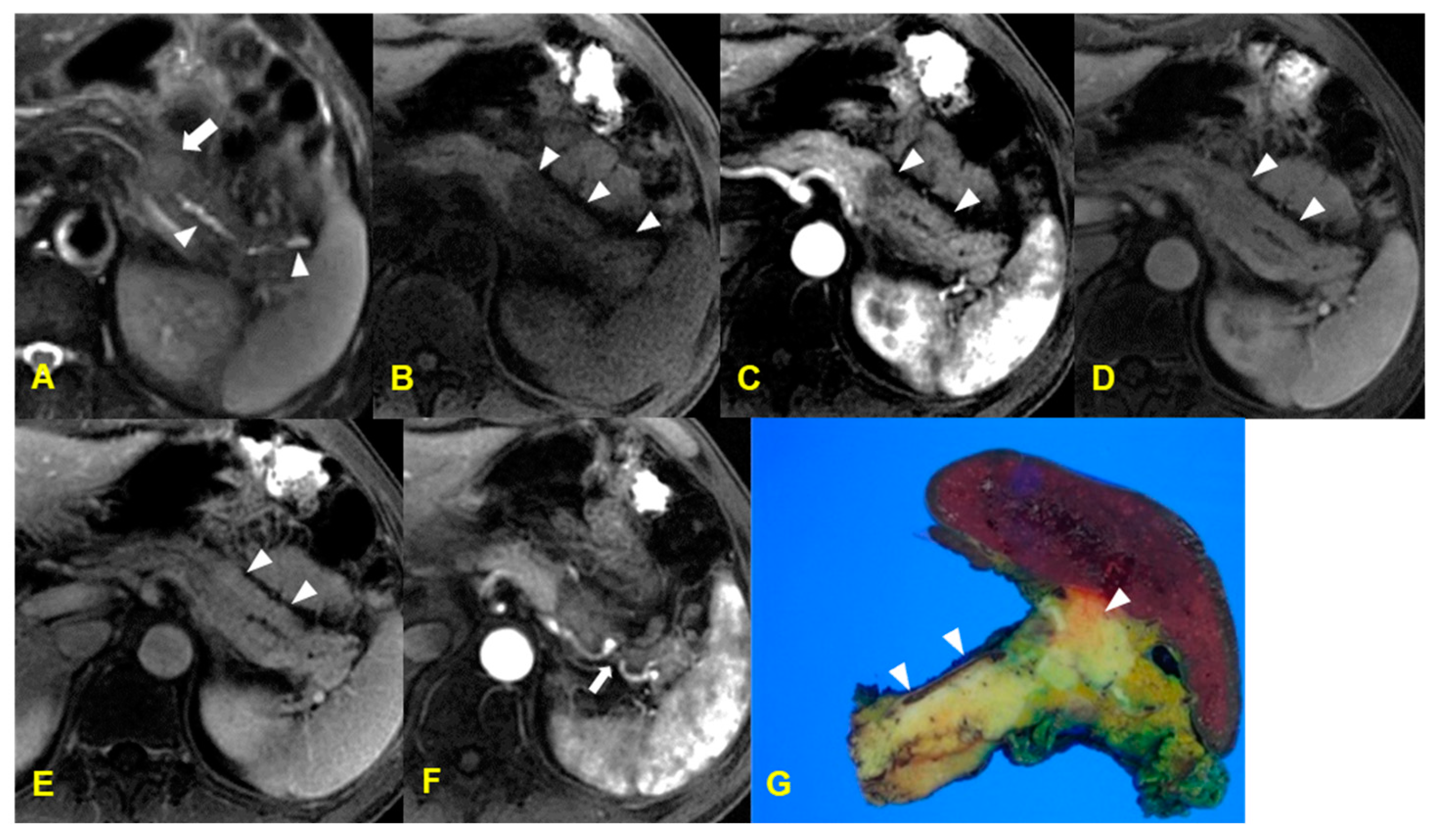 Medicina 60 01766 g008