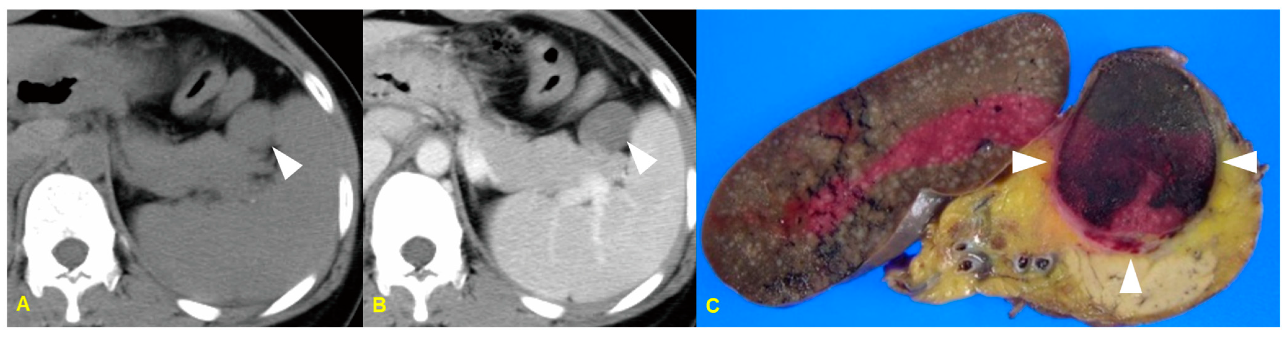 Medicina 60 01766 g009