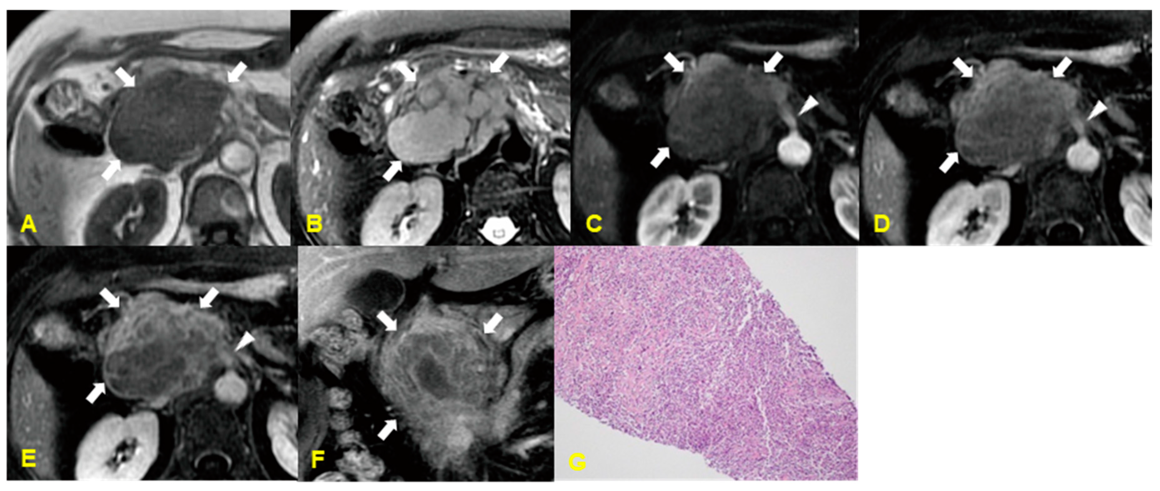 Medicina 60 01766 g010