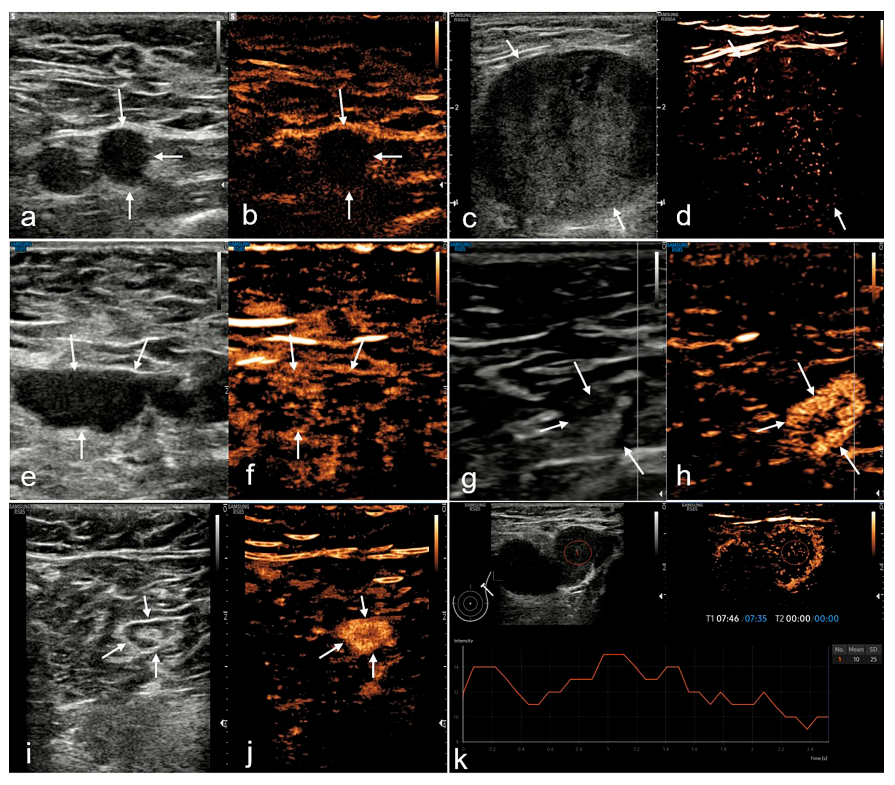 Medicina 60 01780 g003
