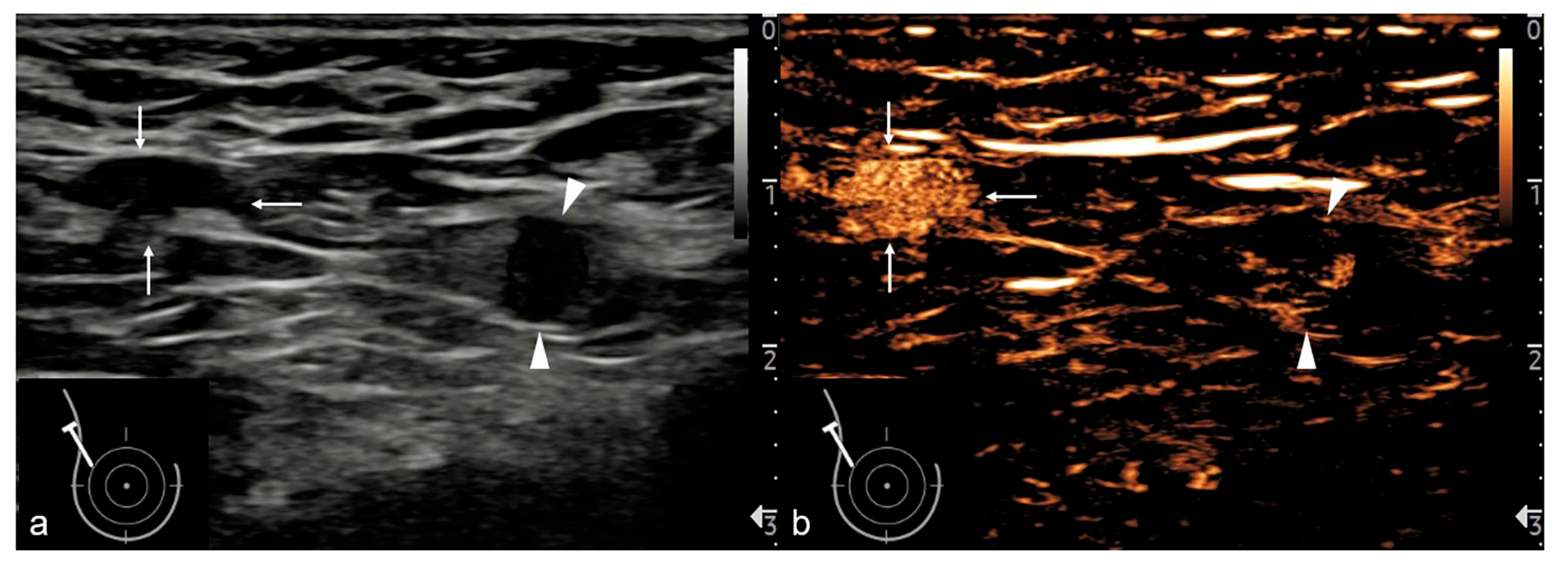 Medicina 60 01780 g006
