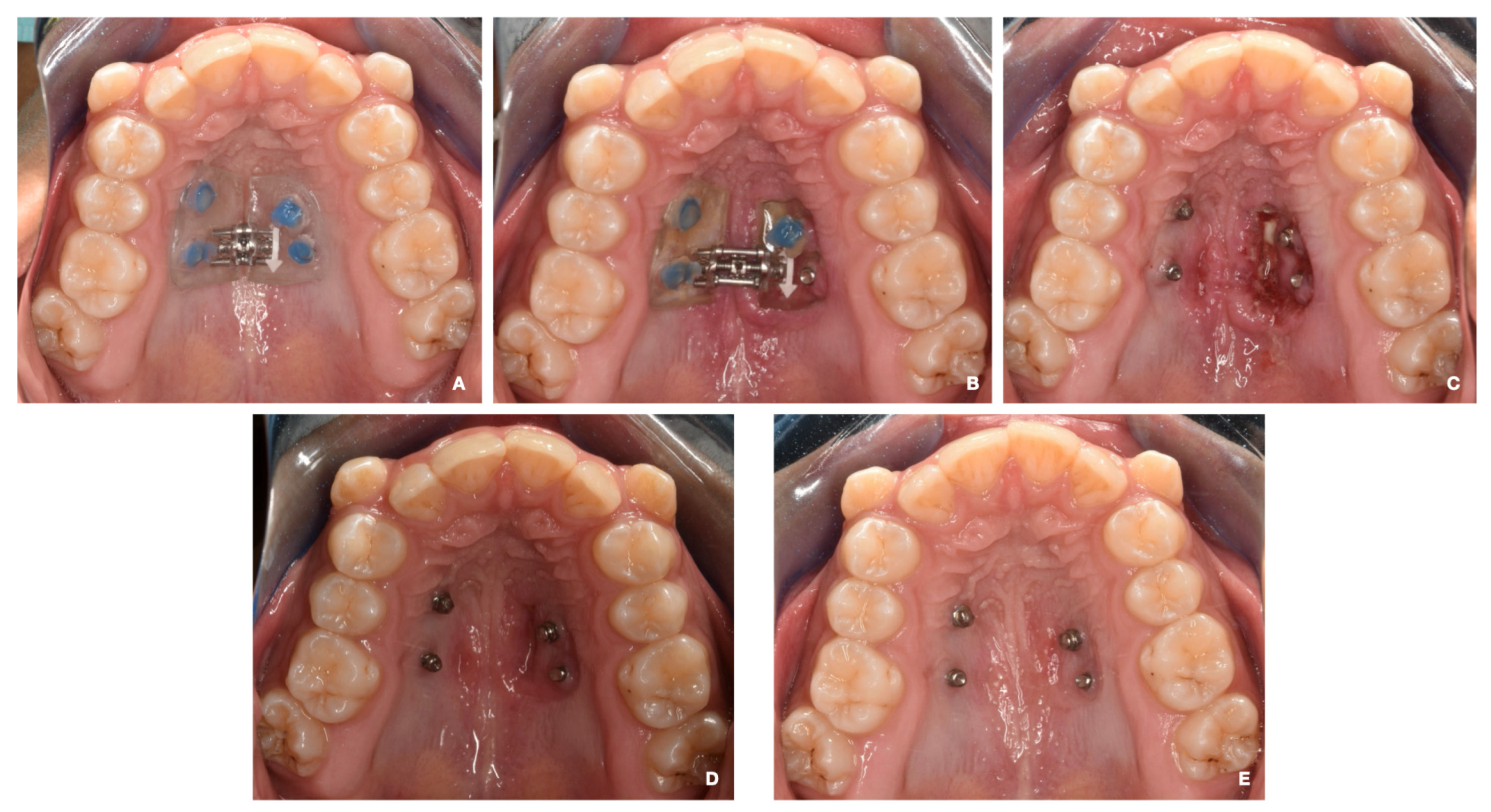 Medicina 60 01784 g003 Medicina 60 01784 g003