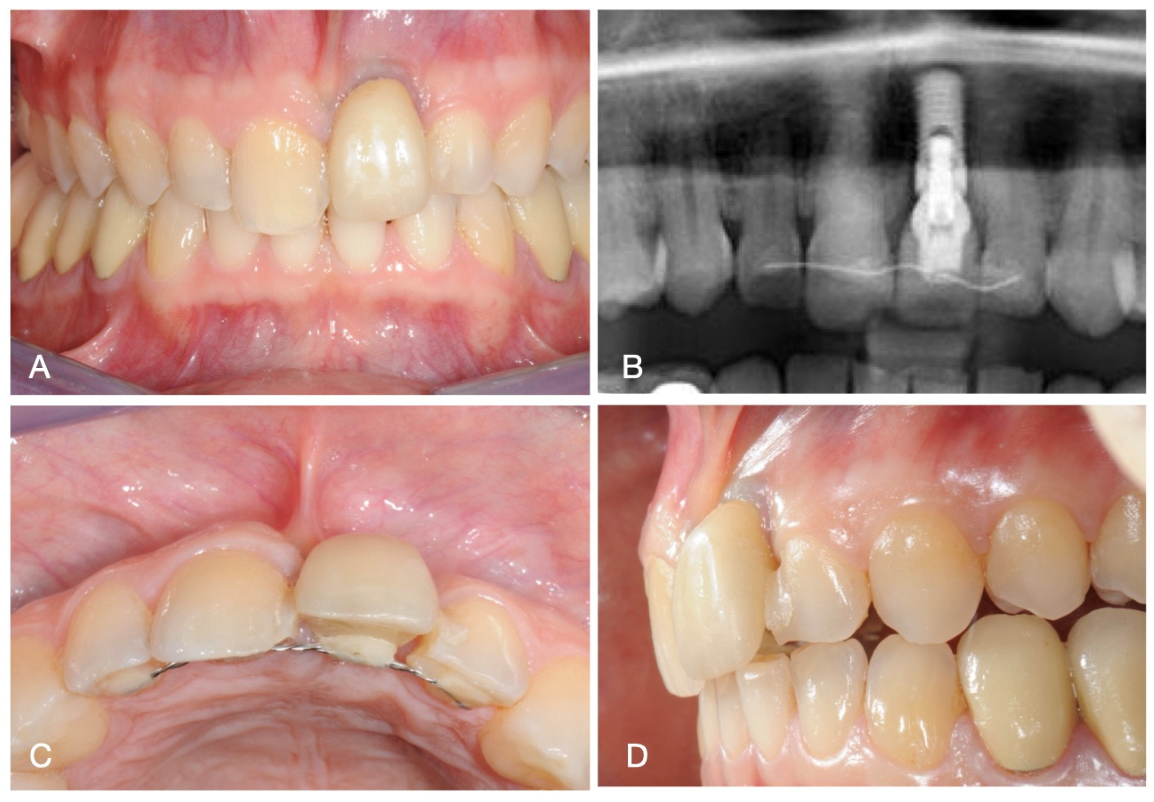 Medicina 60 01786 g001