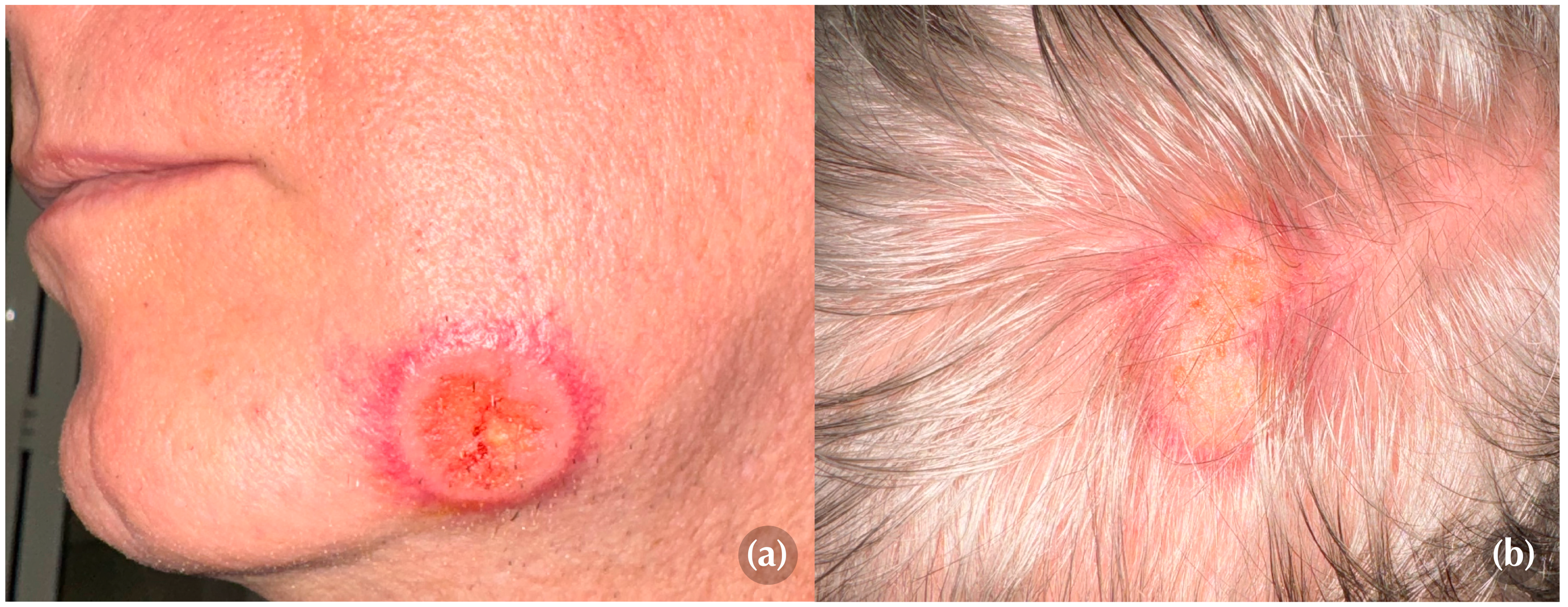 Medicina 60 01797 g001