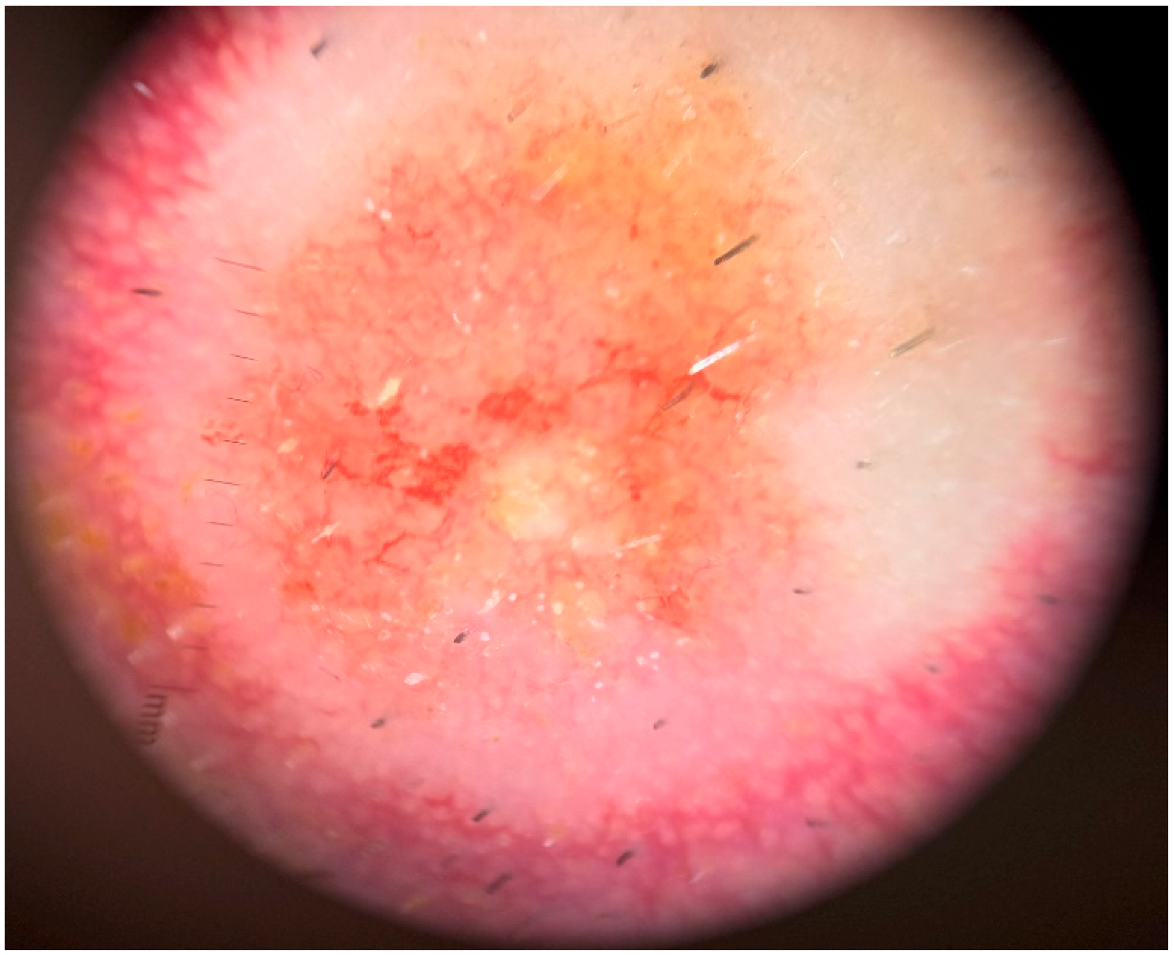 Medicina 60 01797 g002