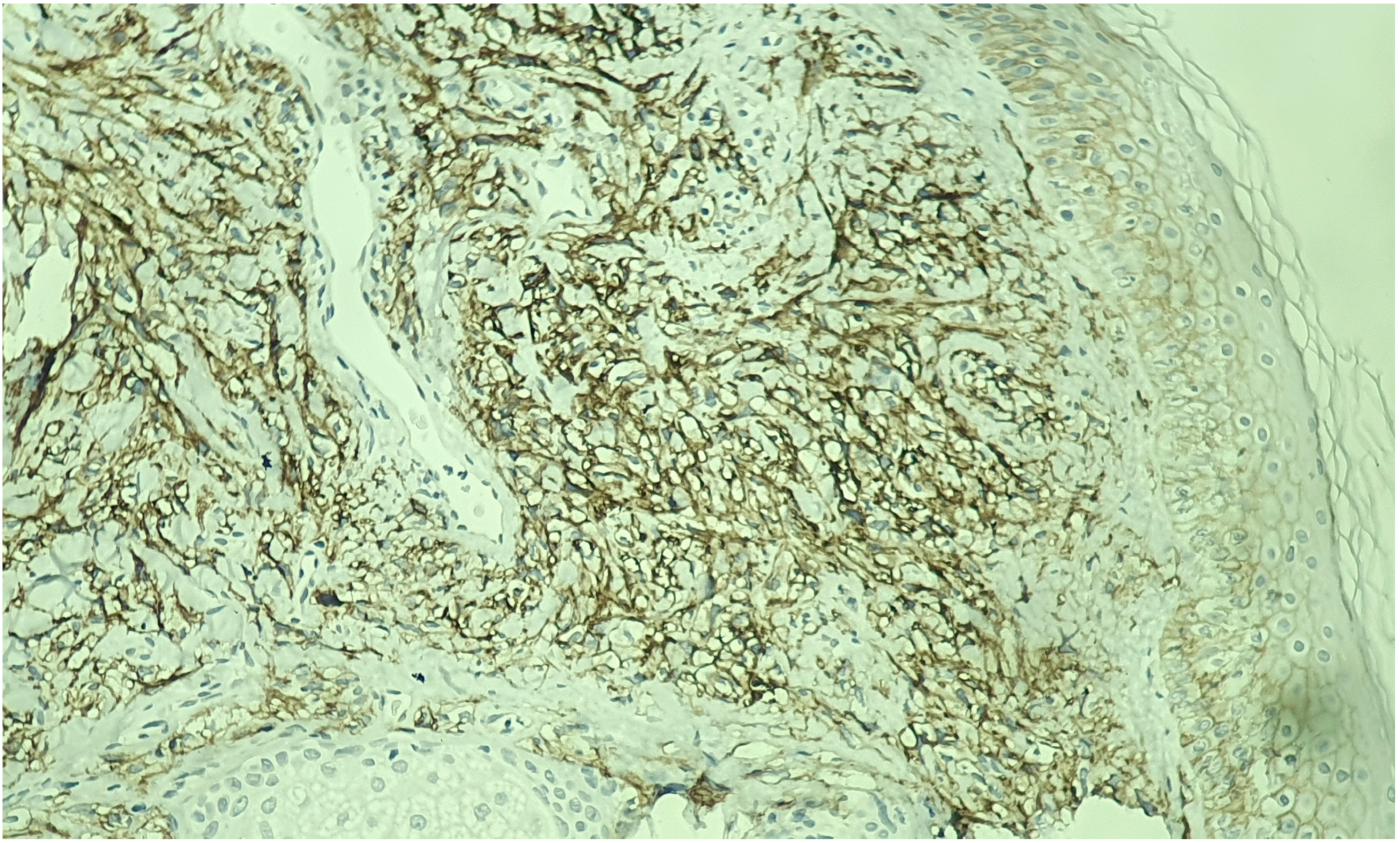 Medicina 60 01797 g004