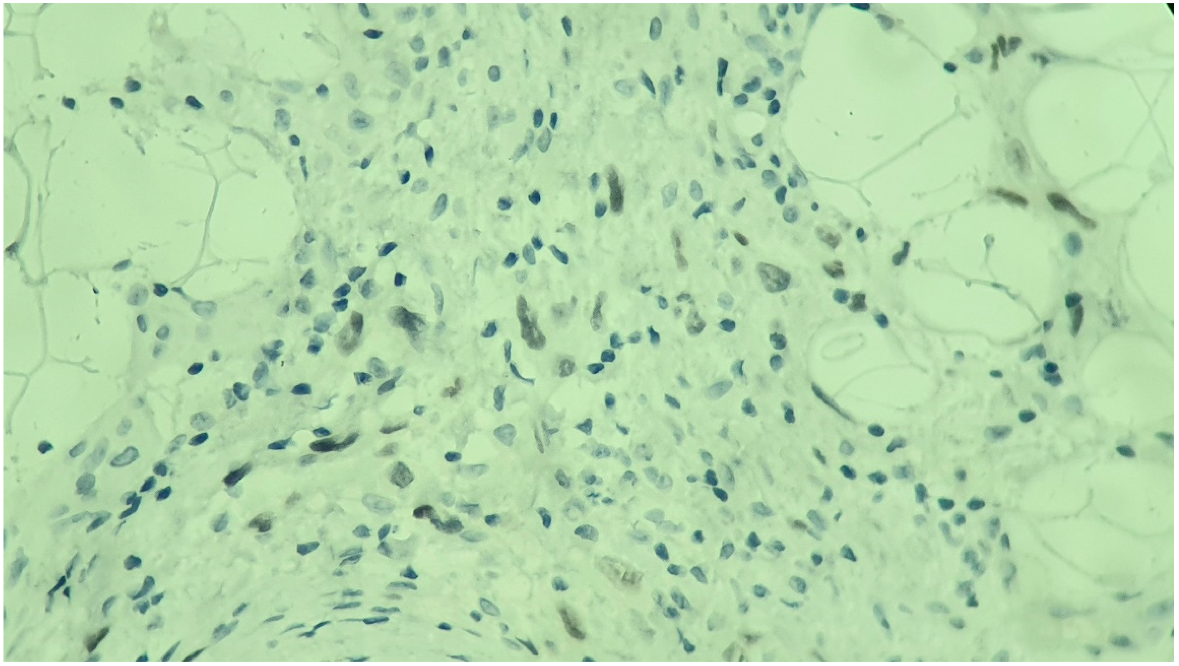 Medicina 60 01797 g005