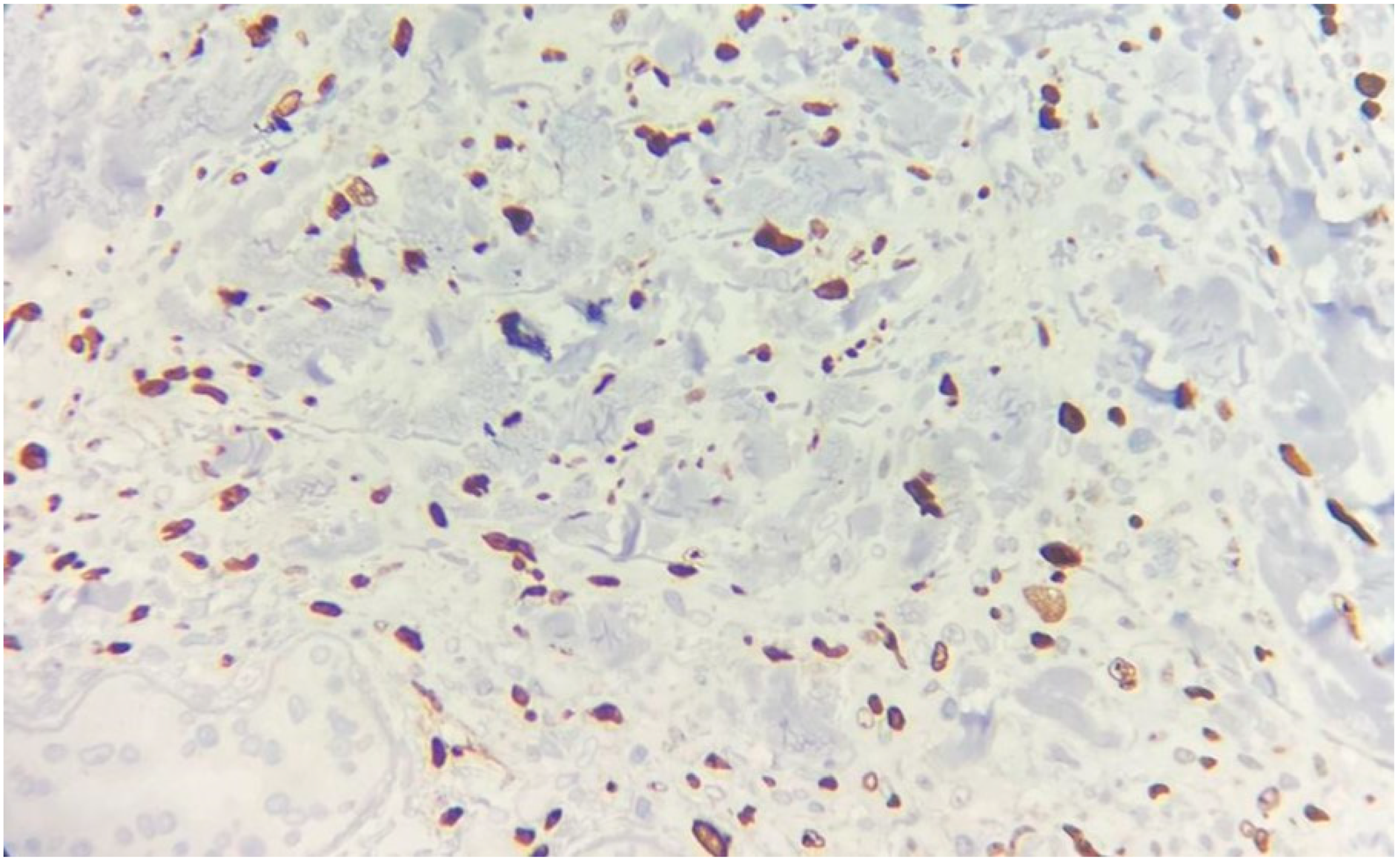 Medicina 60 01797 g006