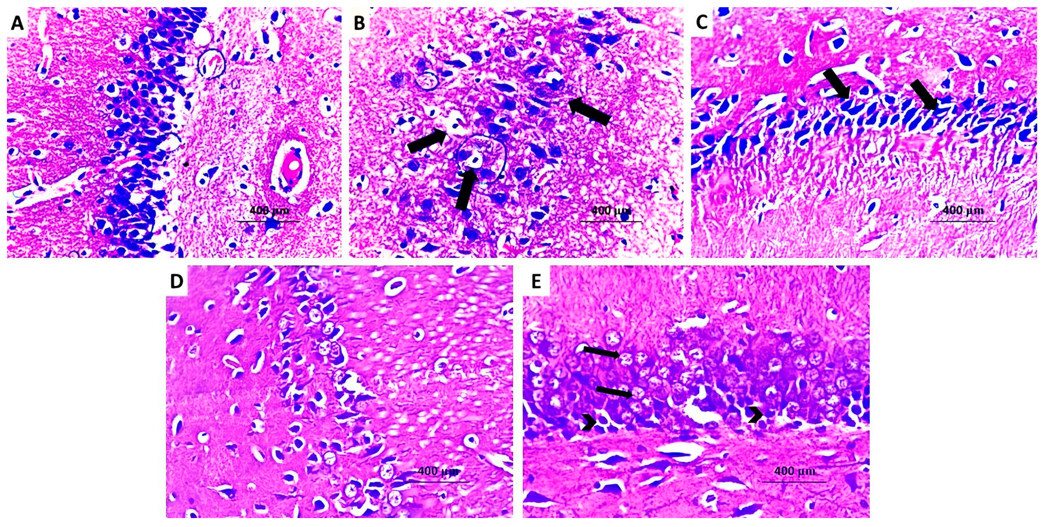 Medicina 60 01802 g014