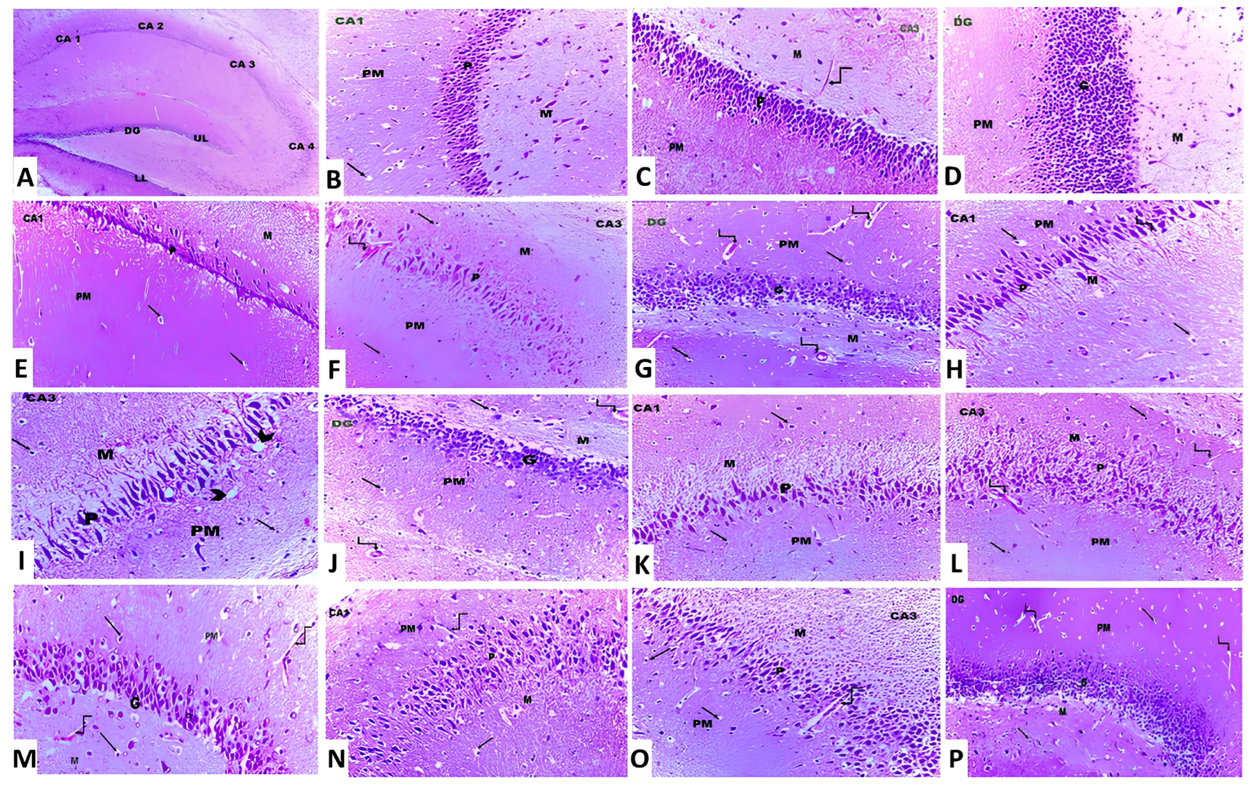 Medicina 60 01805 g011 Medicina 60 01805 g011