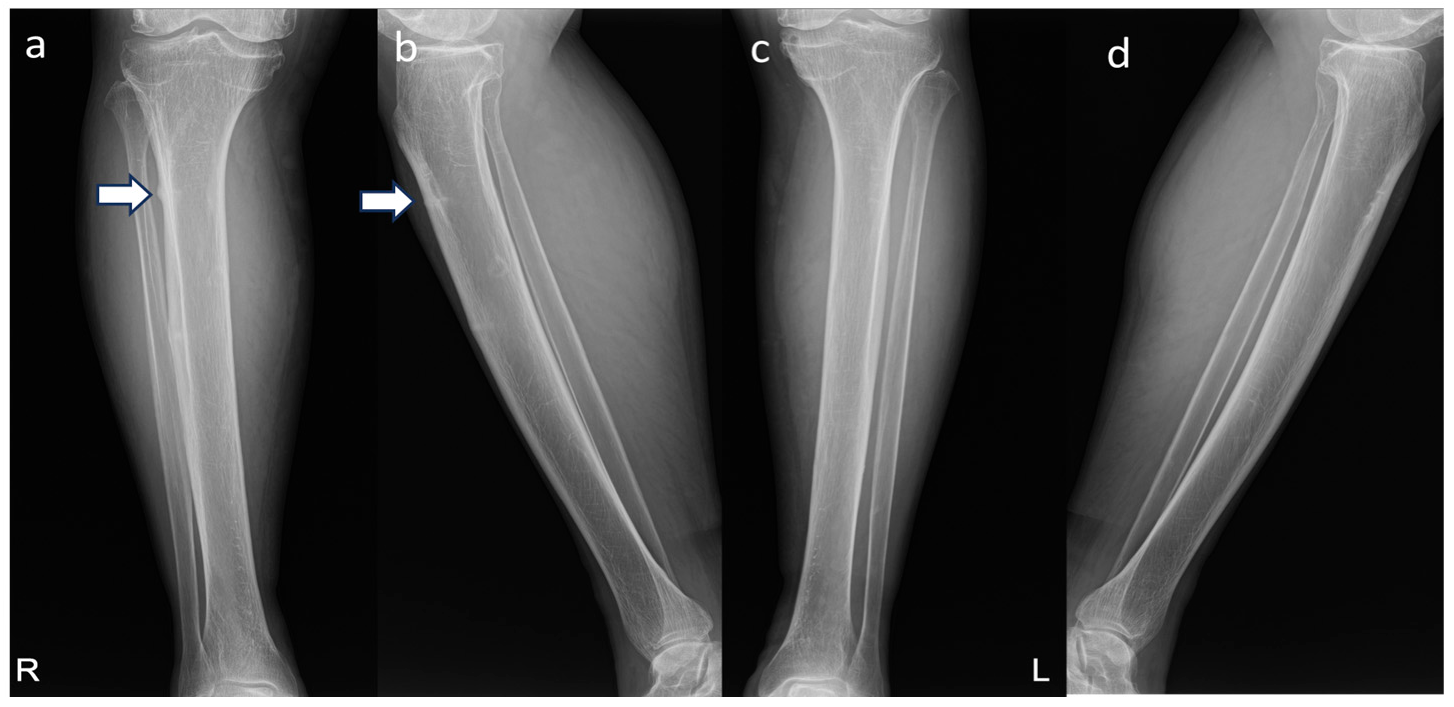 Medicina 60 01814 g001