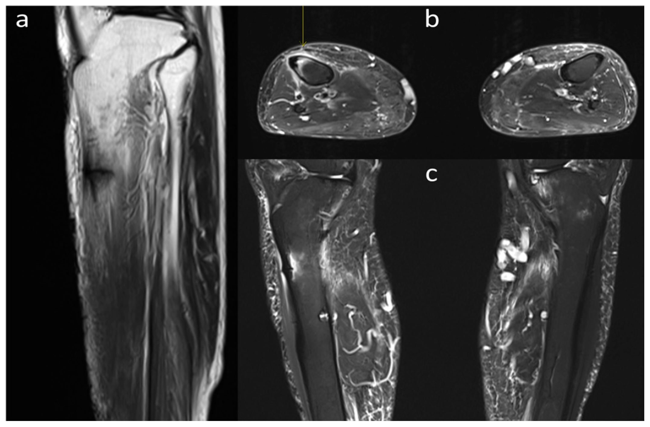 Medicina 60 01814 g002