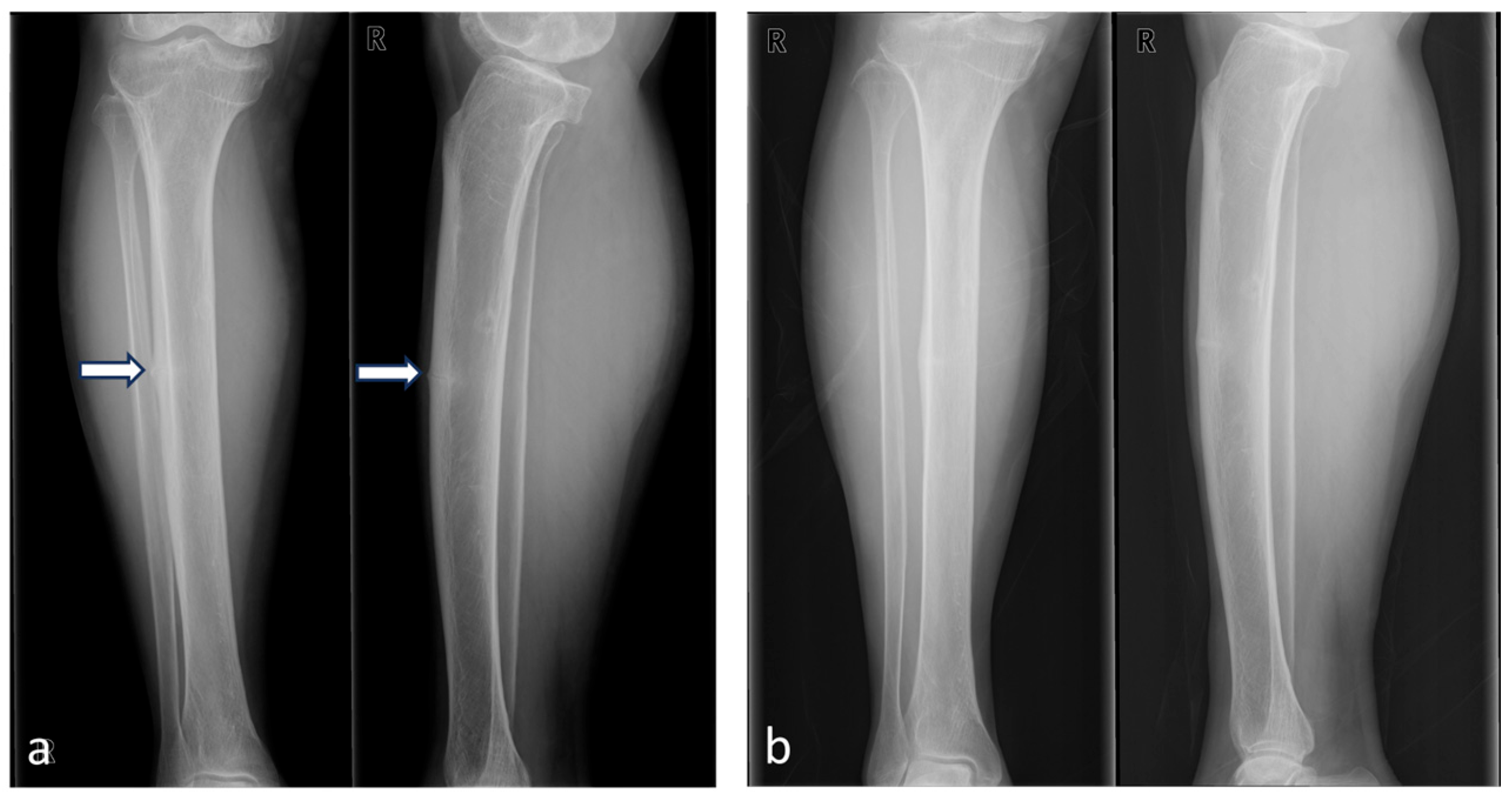 Medicina 60 01814 g003