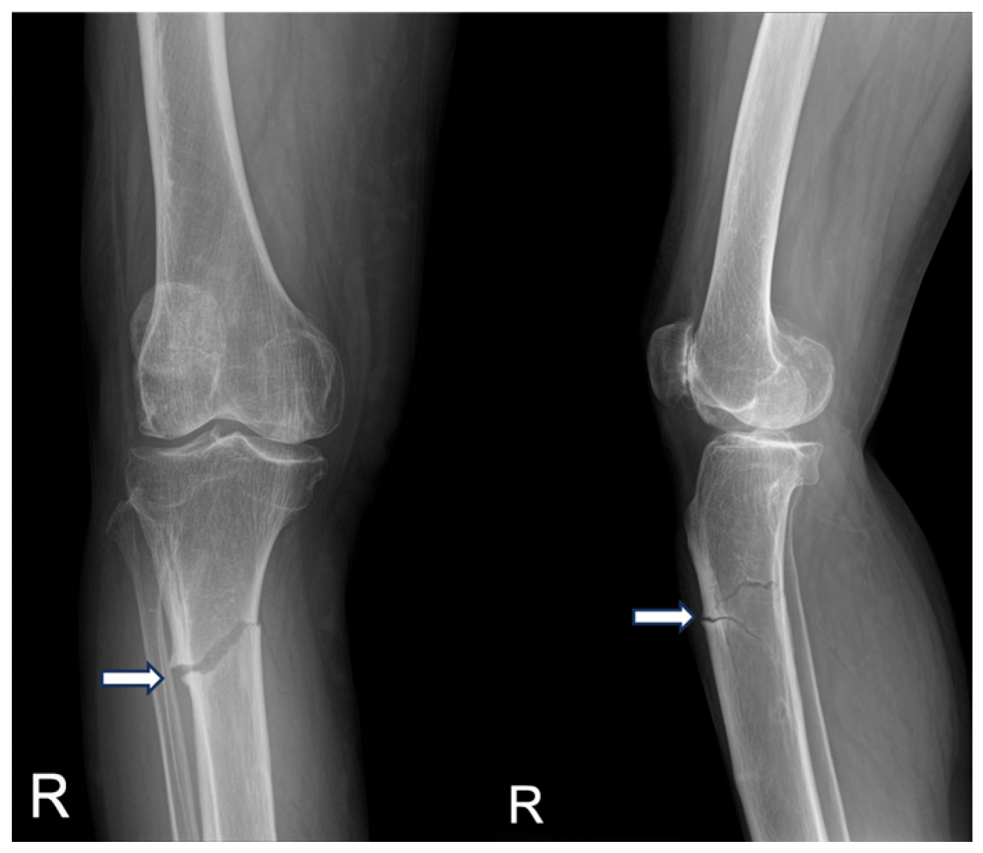 Medicina 60 01814 g006