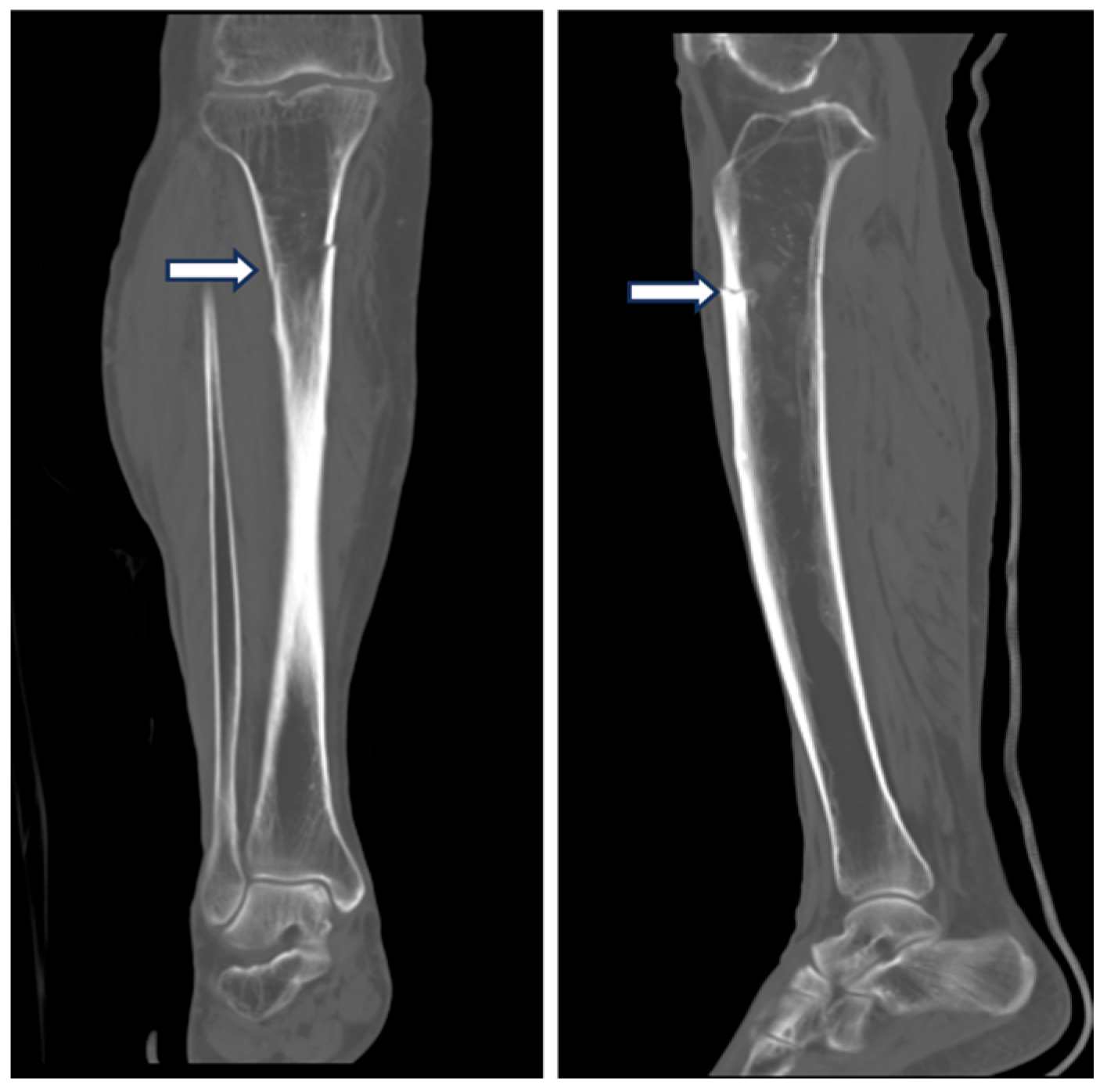 Medicina 60 01814 g007