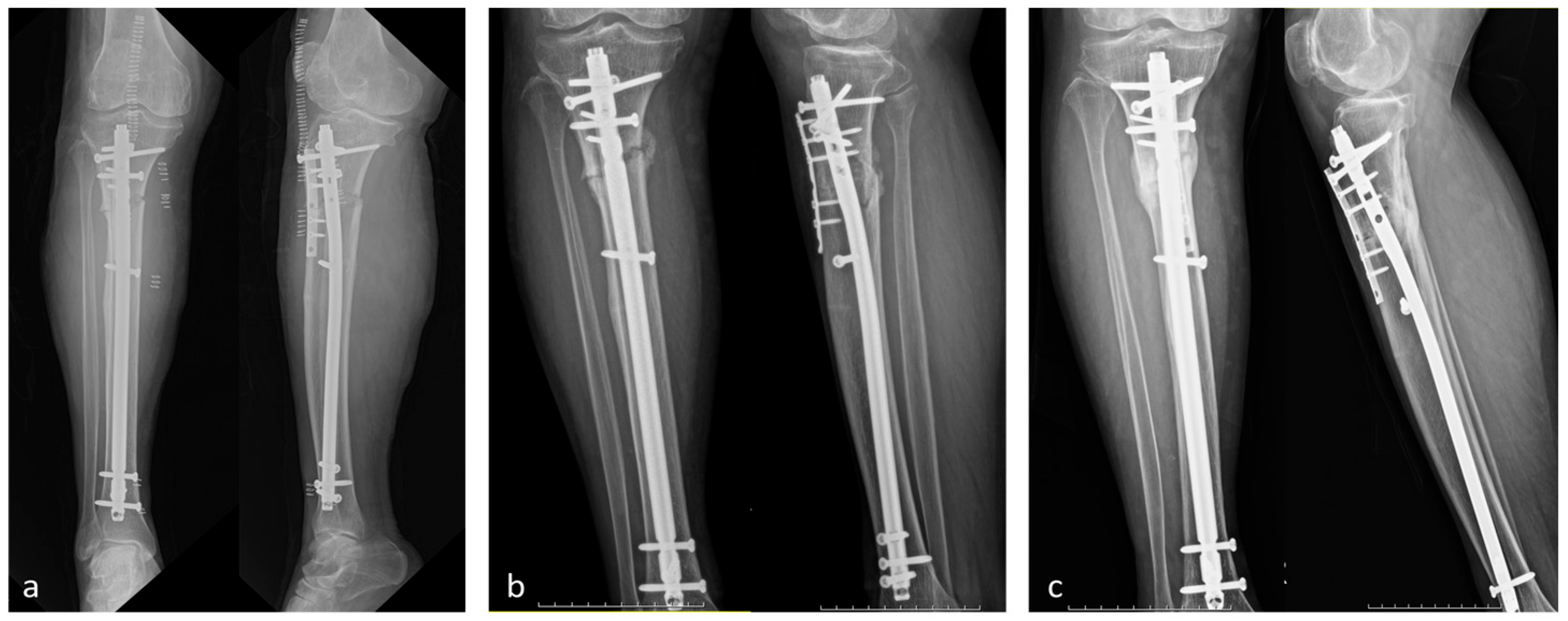 Medicina 60 01814 g008