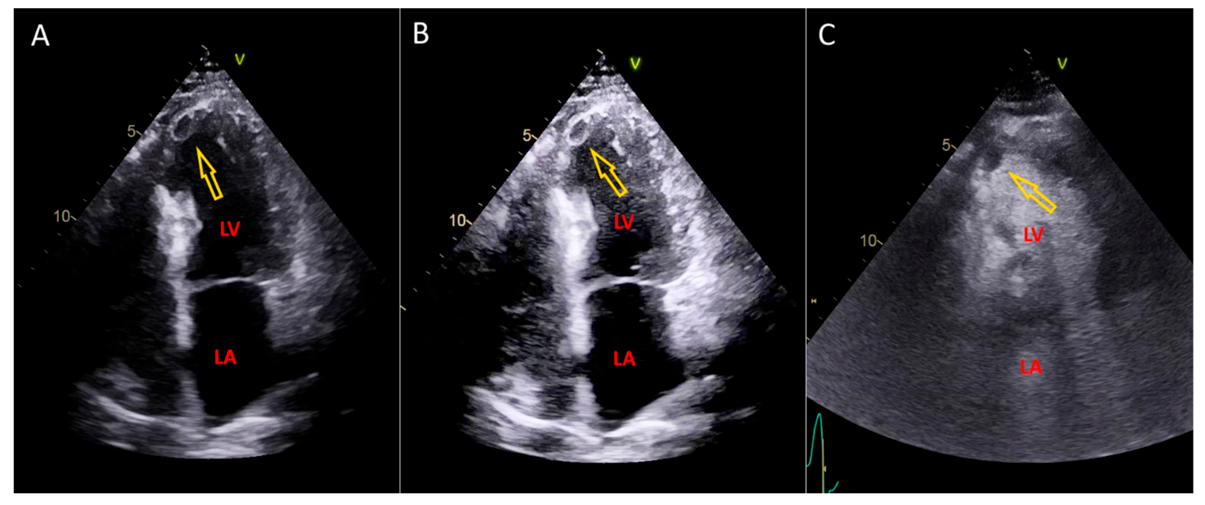 Medicina 60 01815 g004