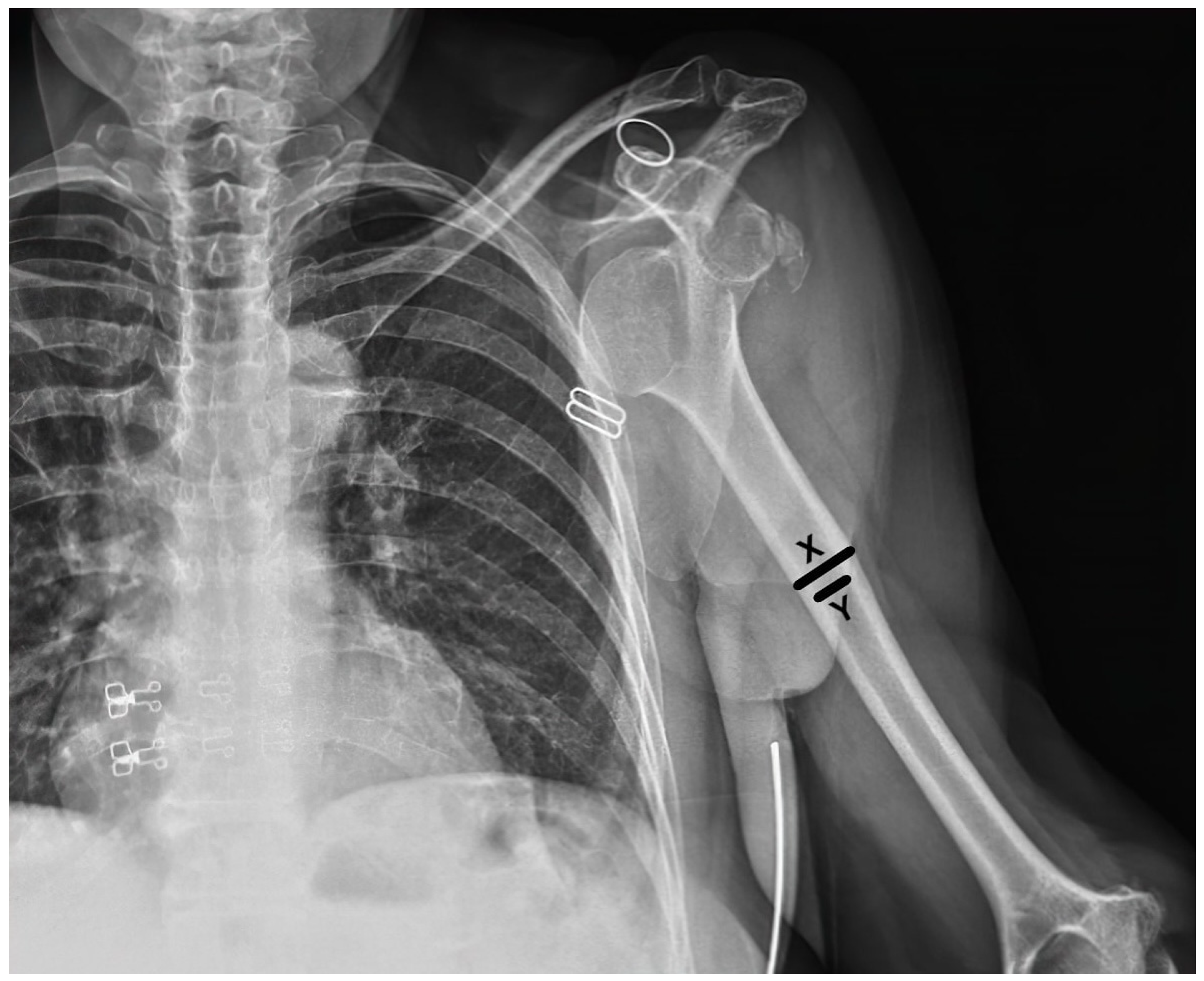 Medicina 60 01816 g001