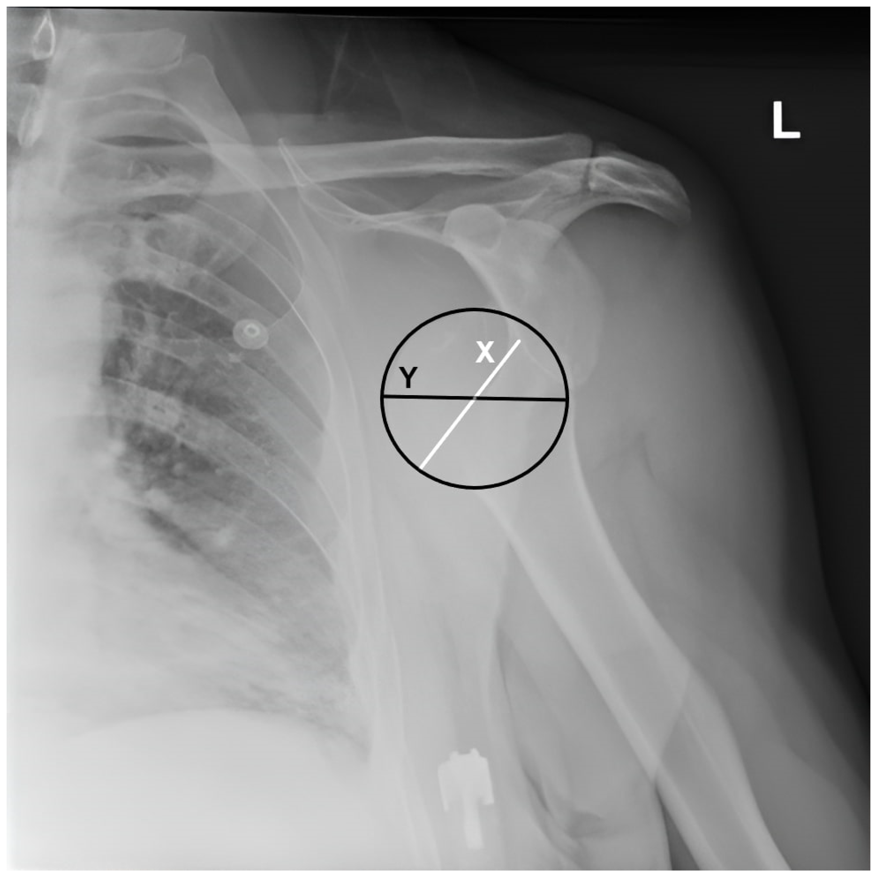 Medicina 60 01816 g002