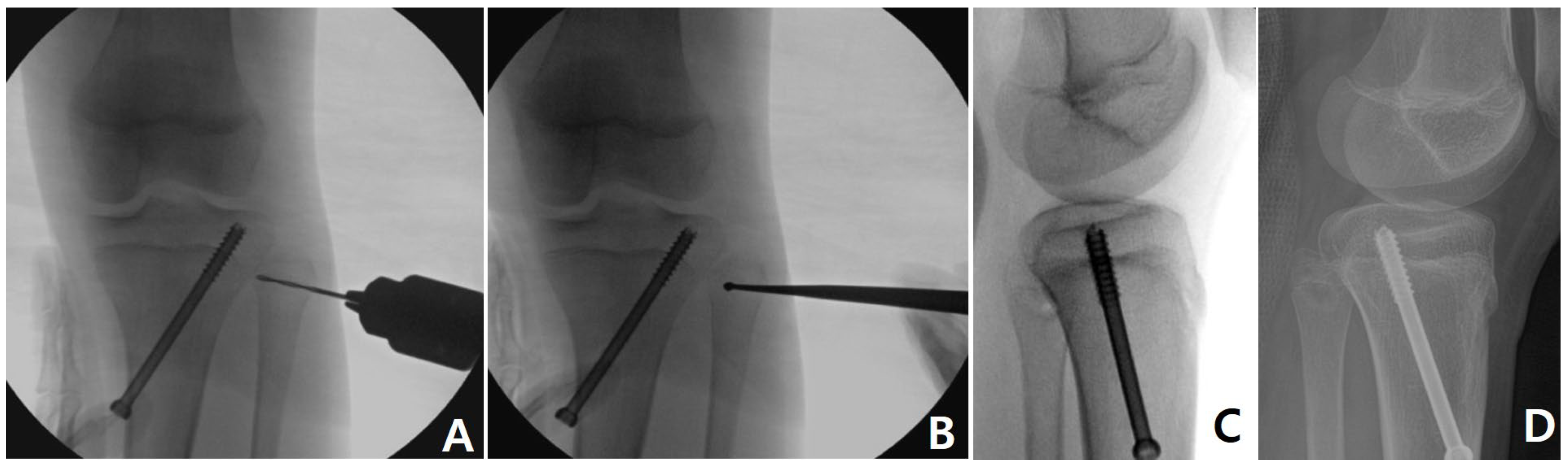 Medicina 60 01818 g002