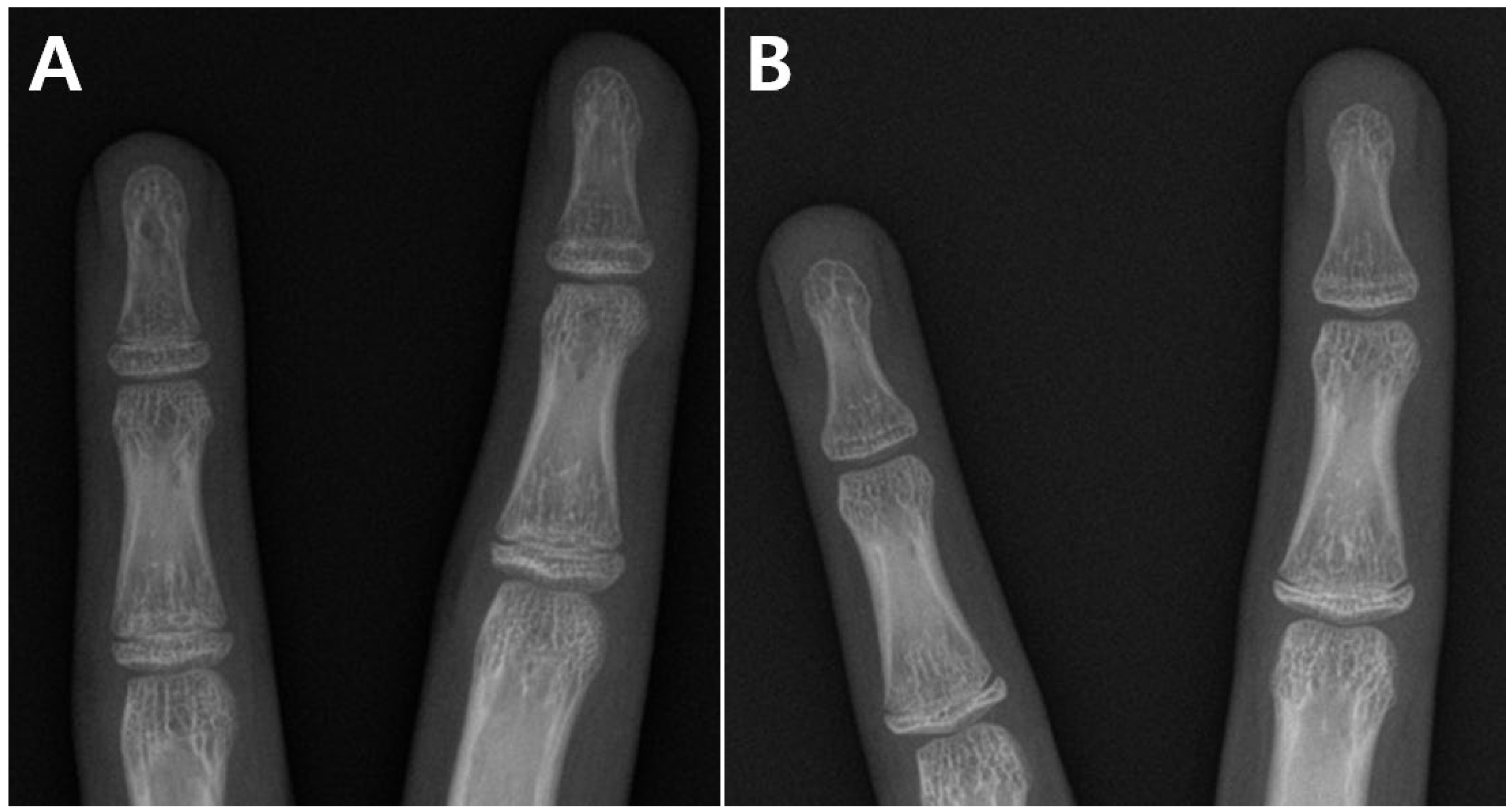 Medicina 60 01818 g003
