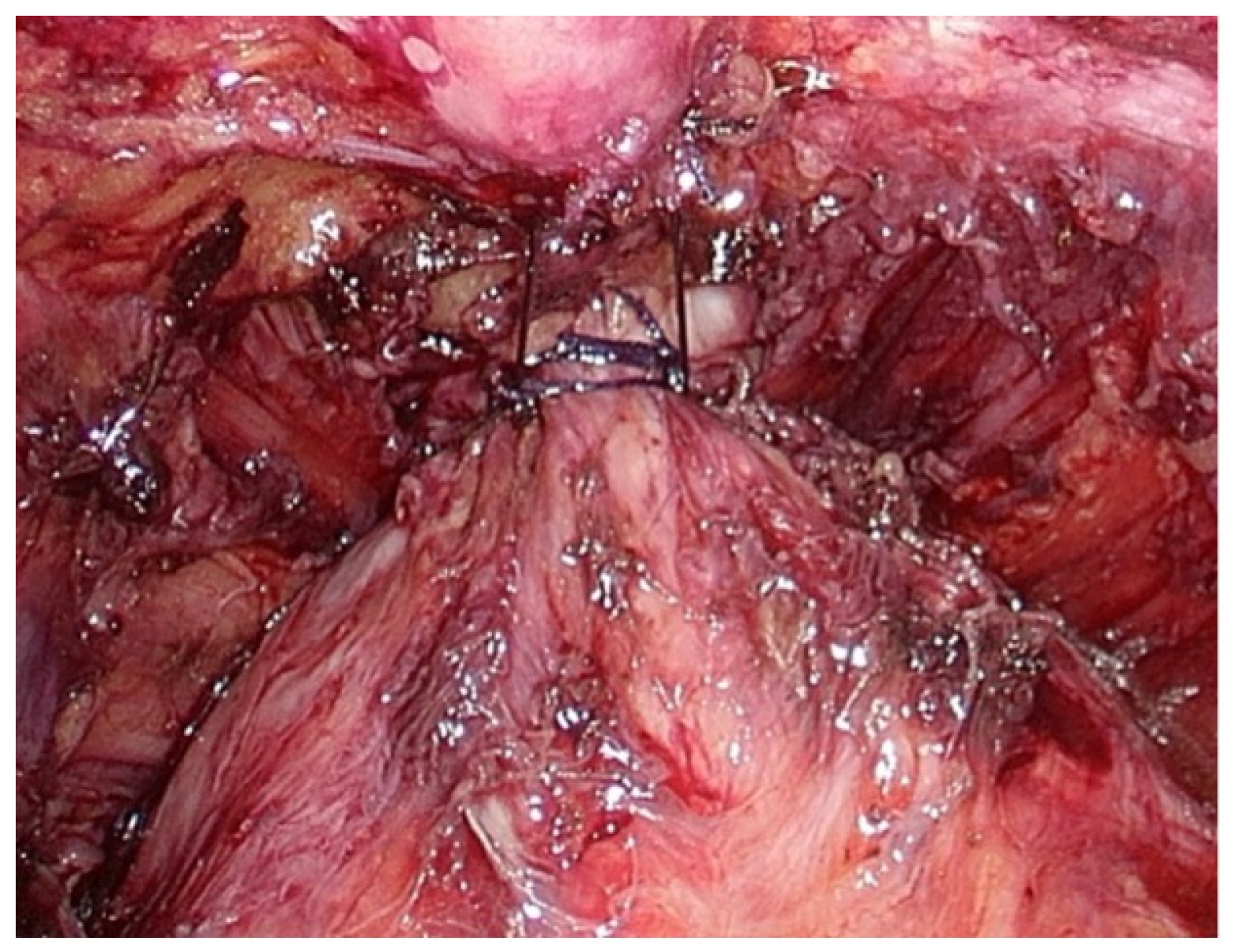 Medicina 60 01824 g001