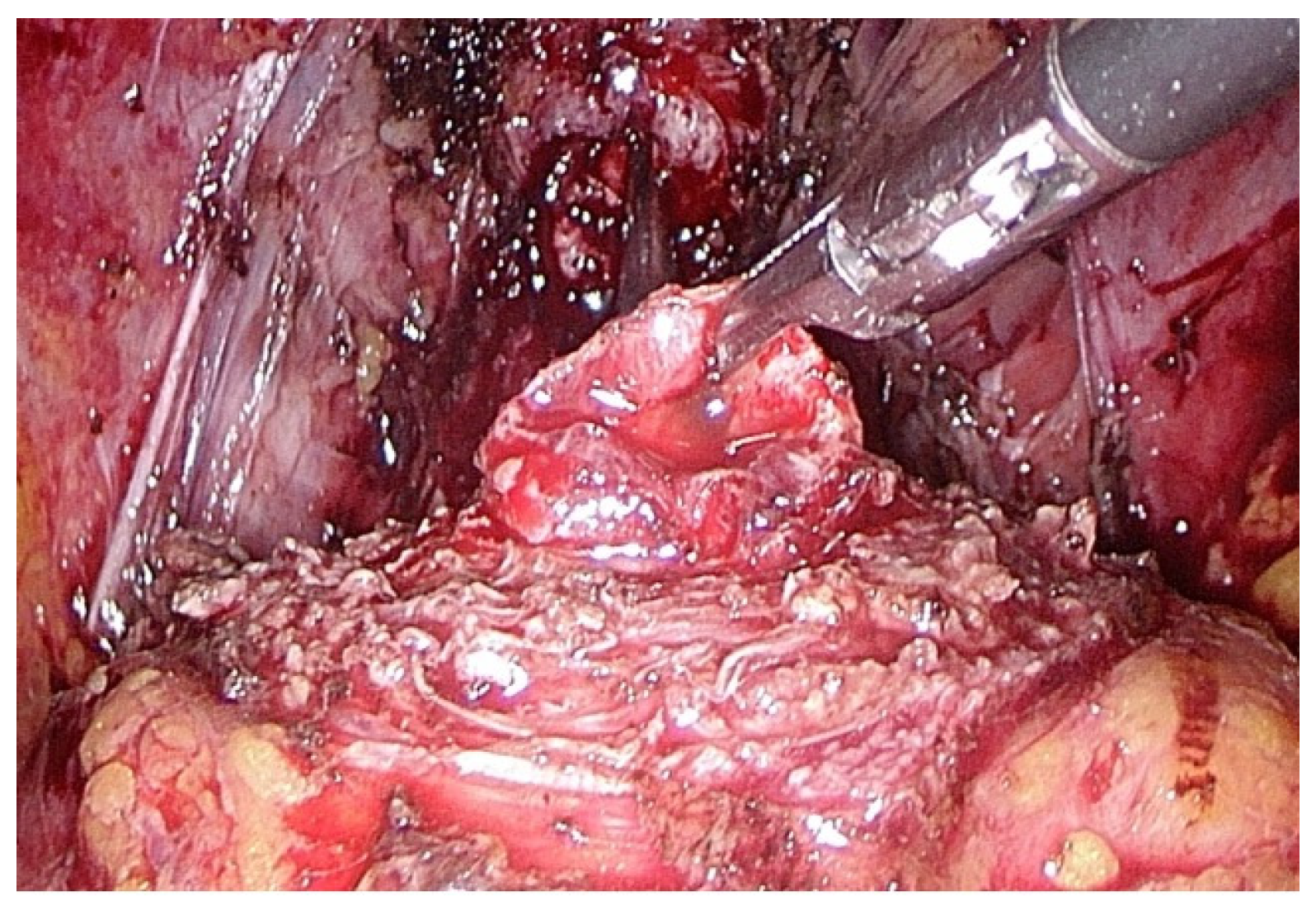 Medicina 60 01824 g002