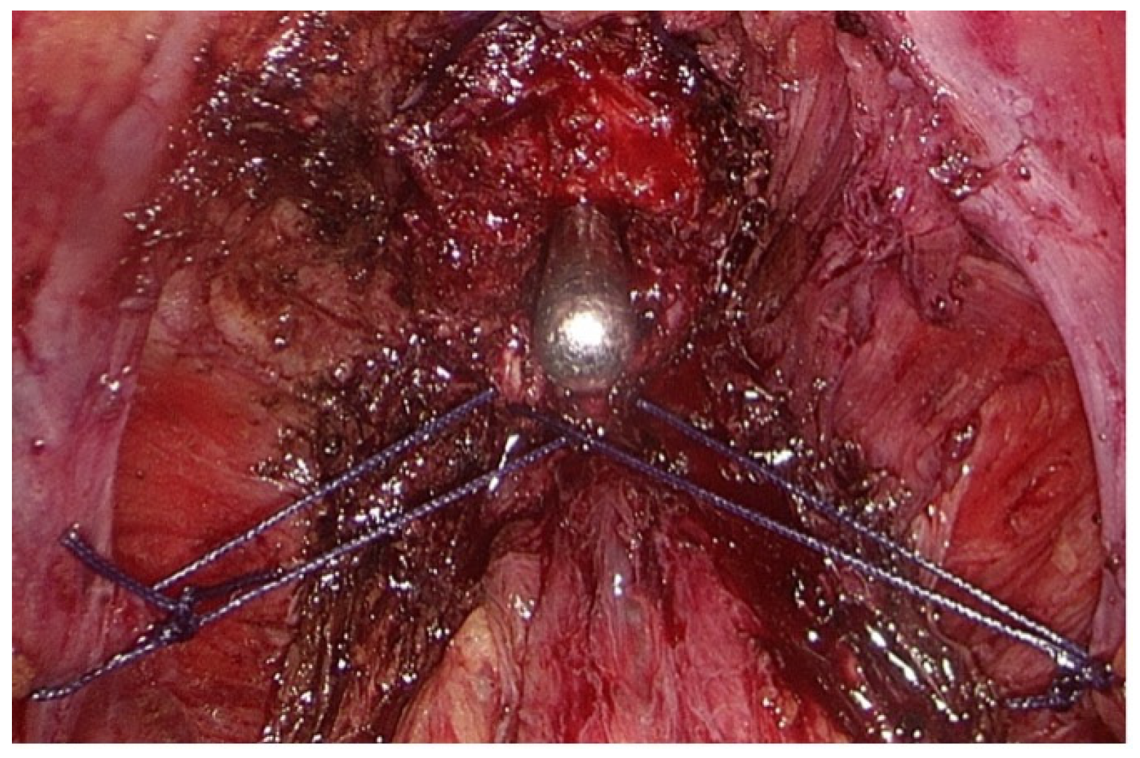 Medicina 60 01824 g003