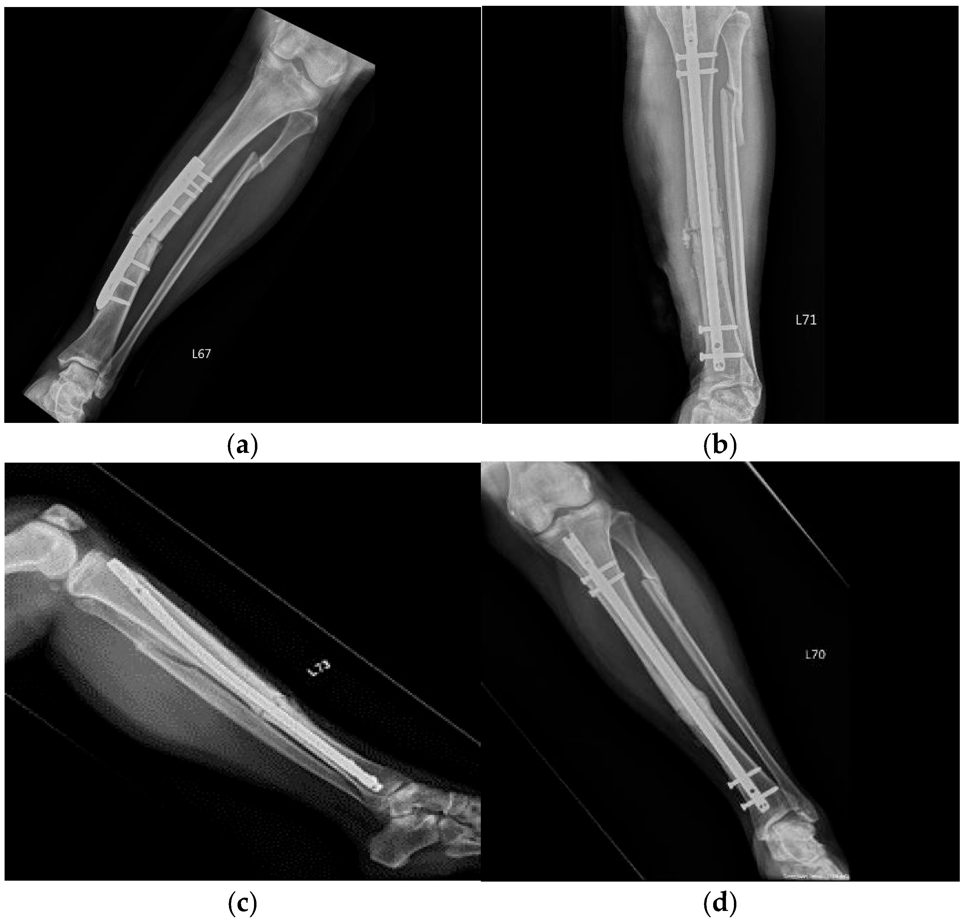 Medicina 60 01832 g002