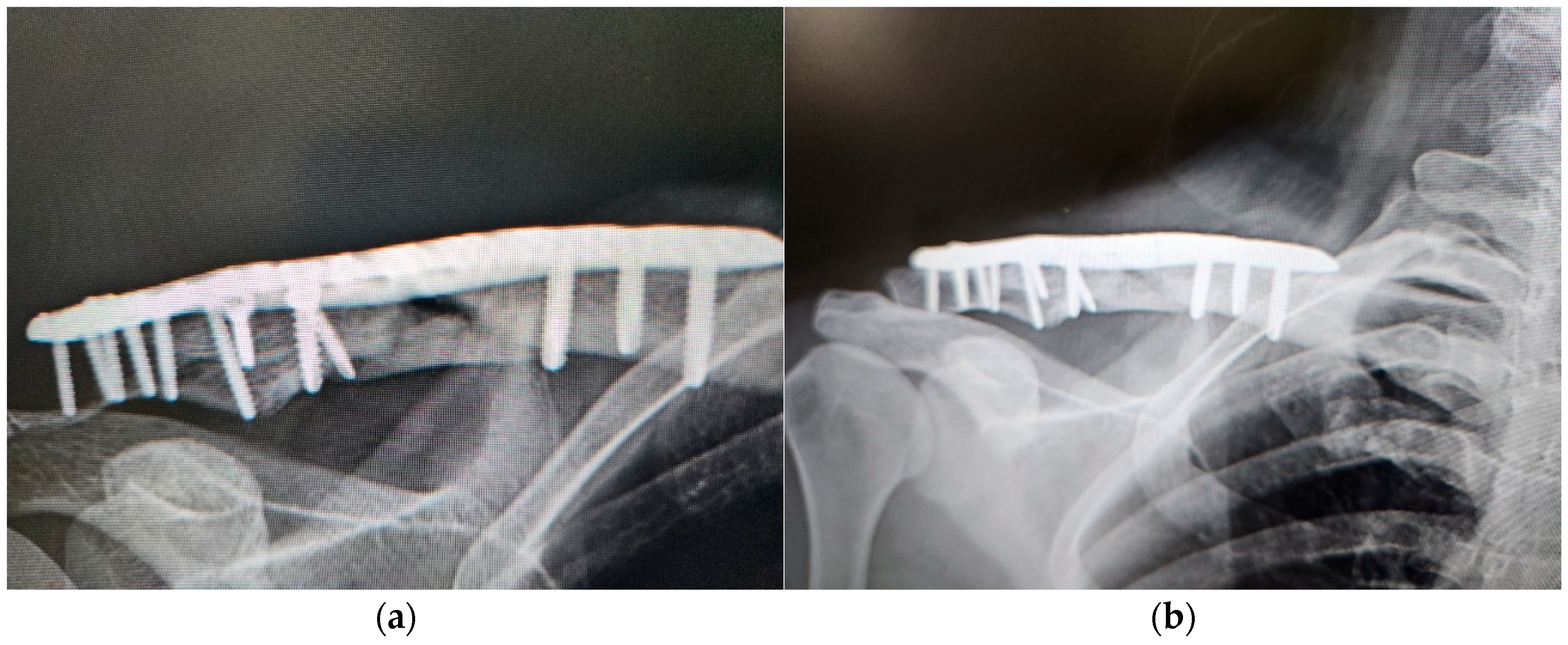 Medicina 60 01832 g003