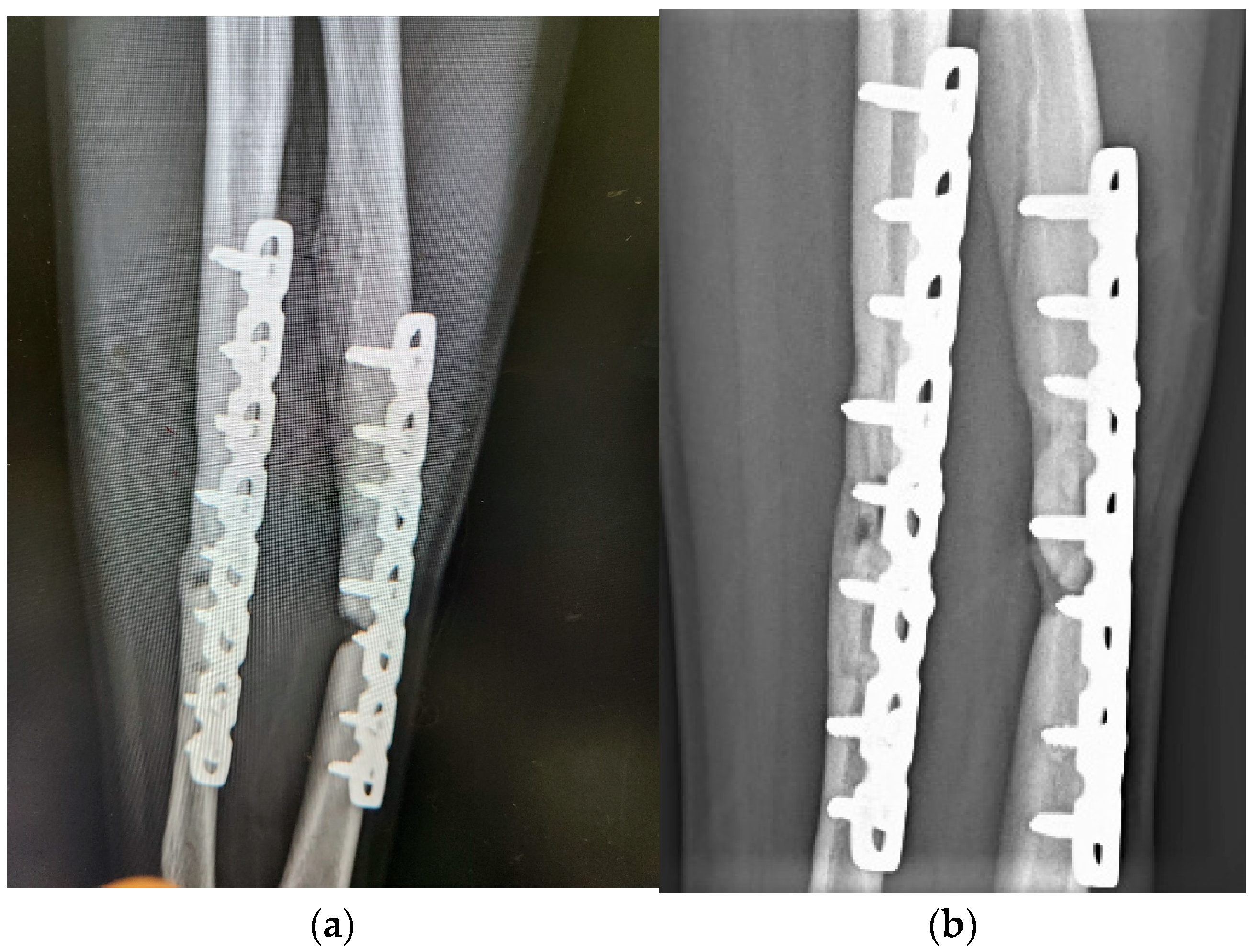 Medicina 60 01832 g005