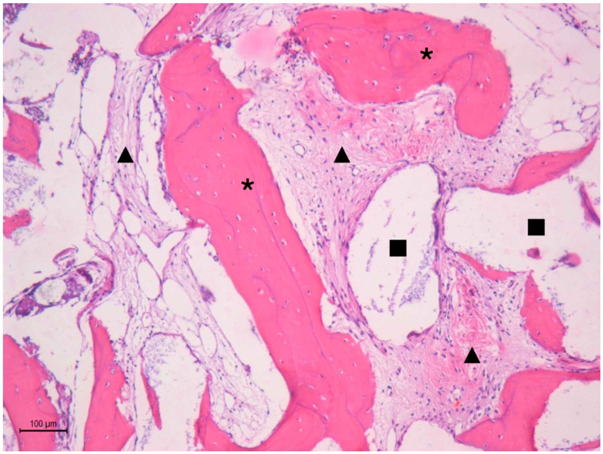 Multiscale Femoral Neck Imaging and Multimodal Trabeculae
