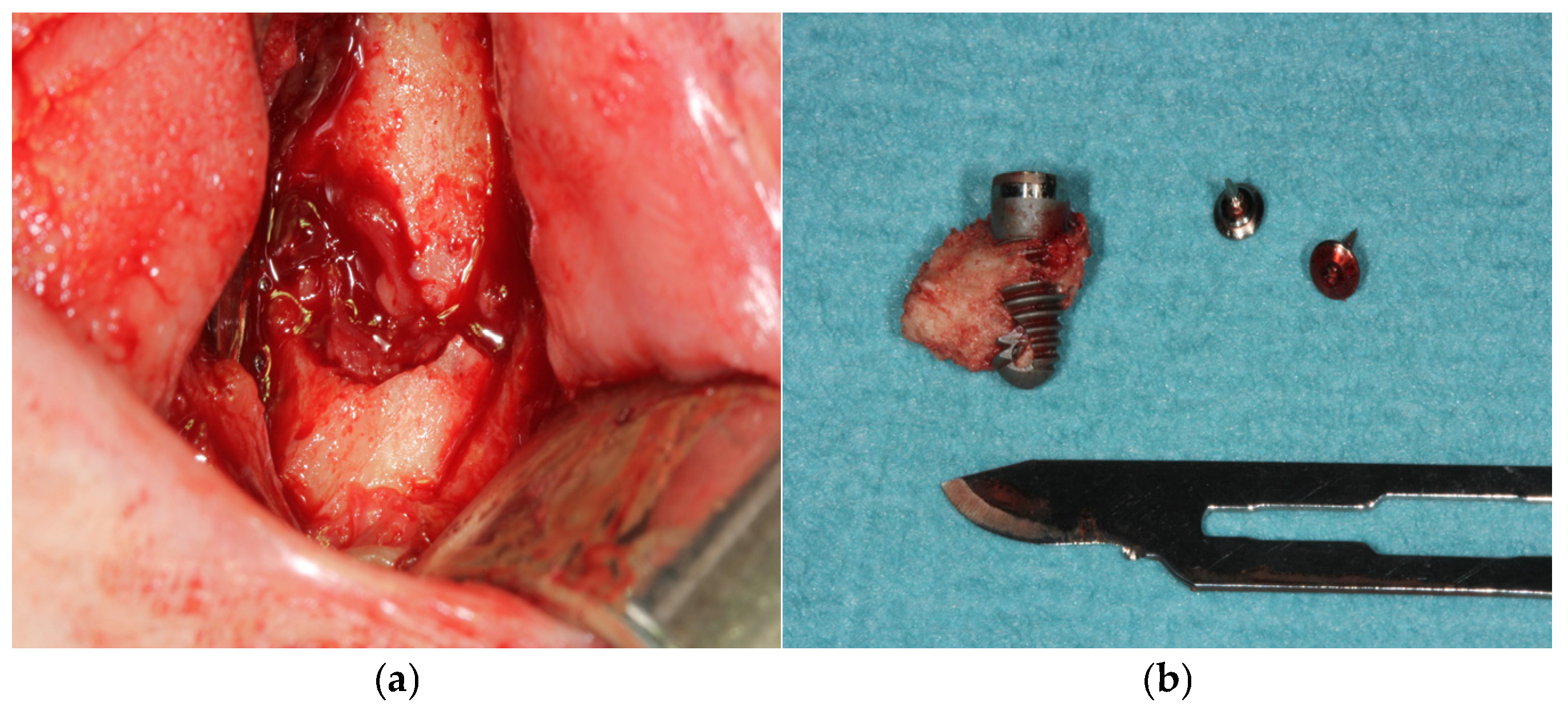 Medicina 60 01835 g001