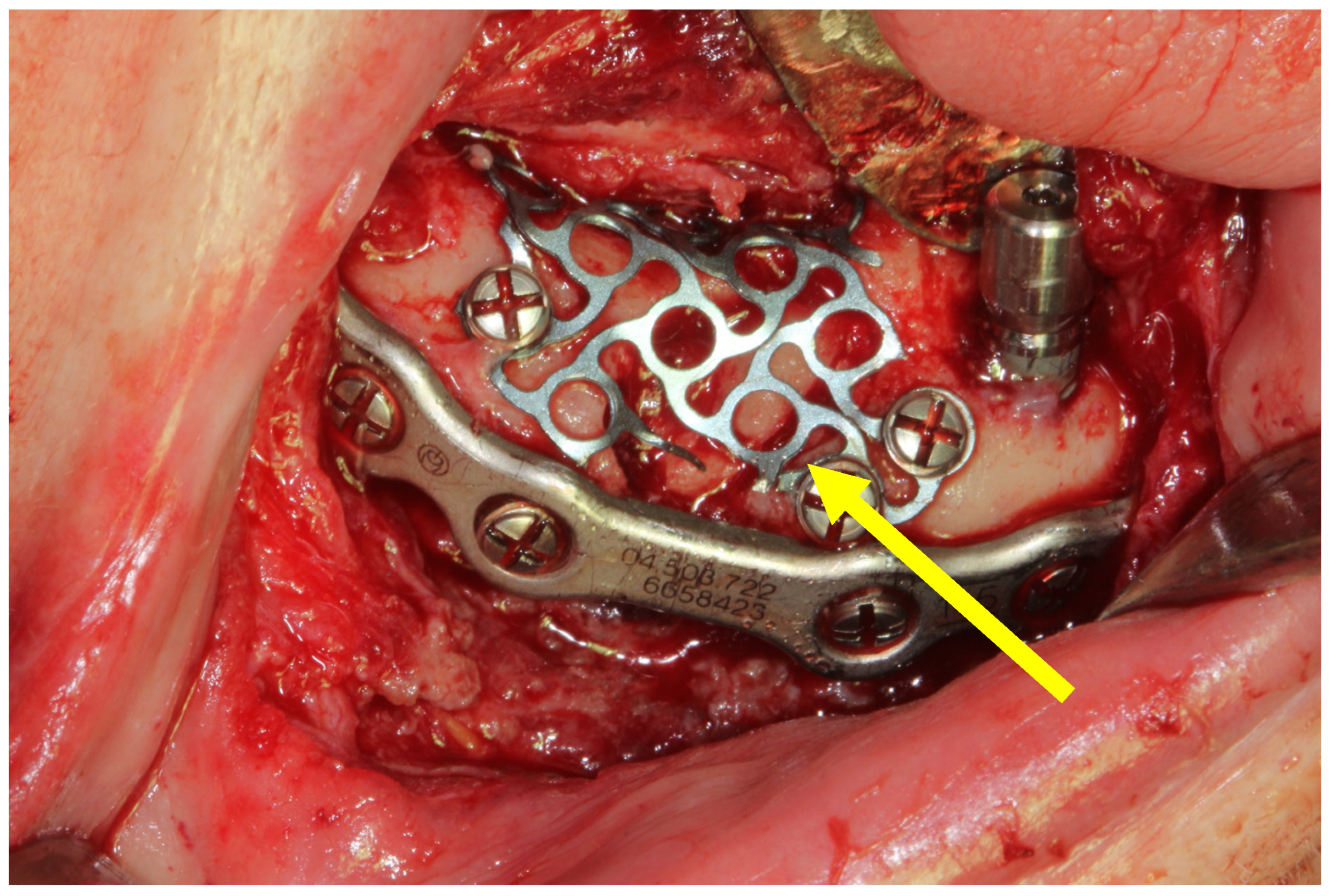 Medicina 60 01835 g002