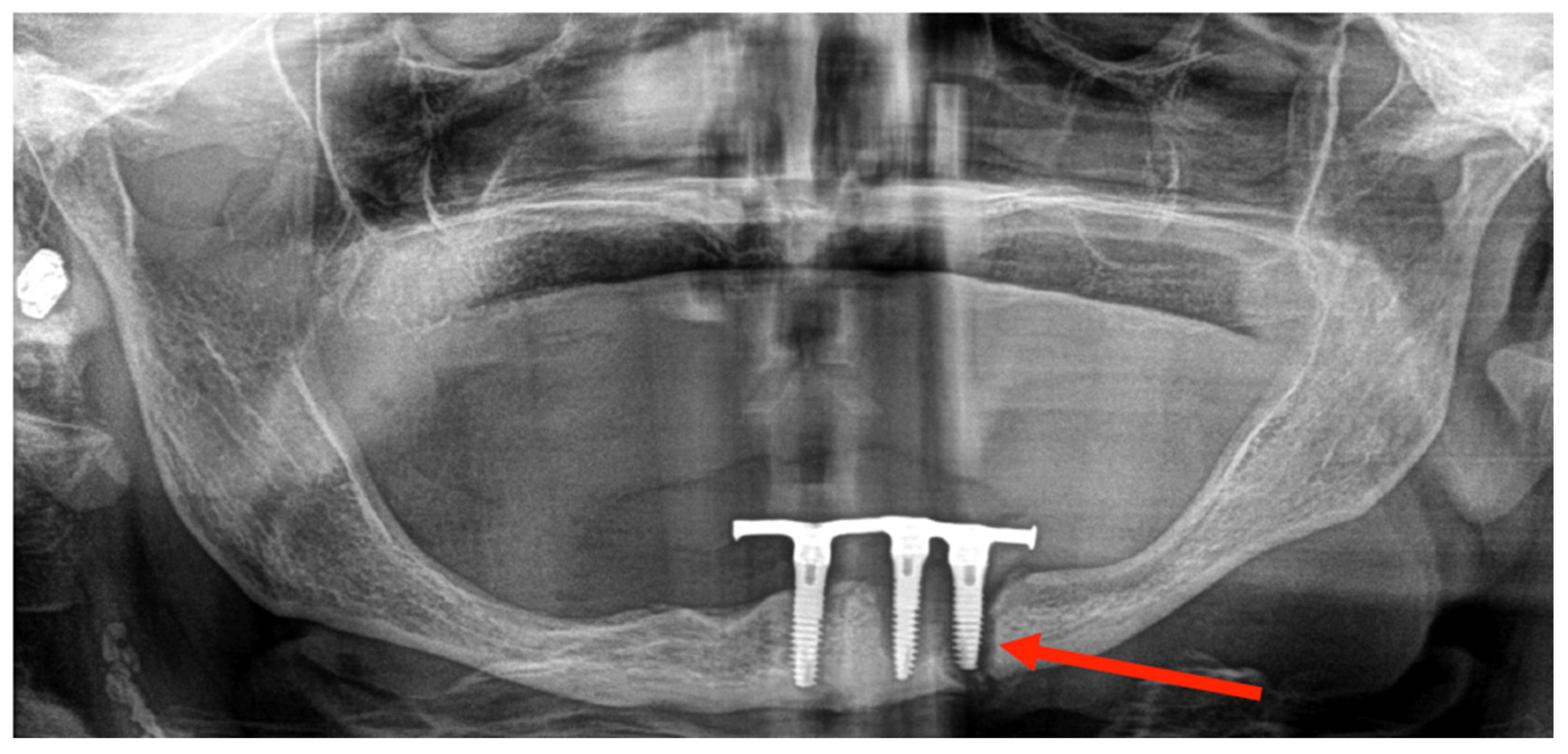 Medicina 60 01835 g004