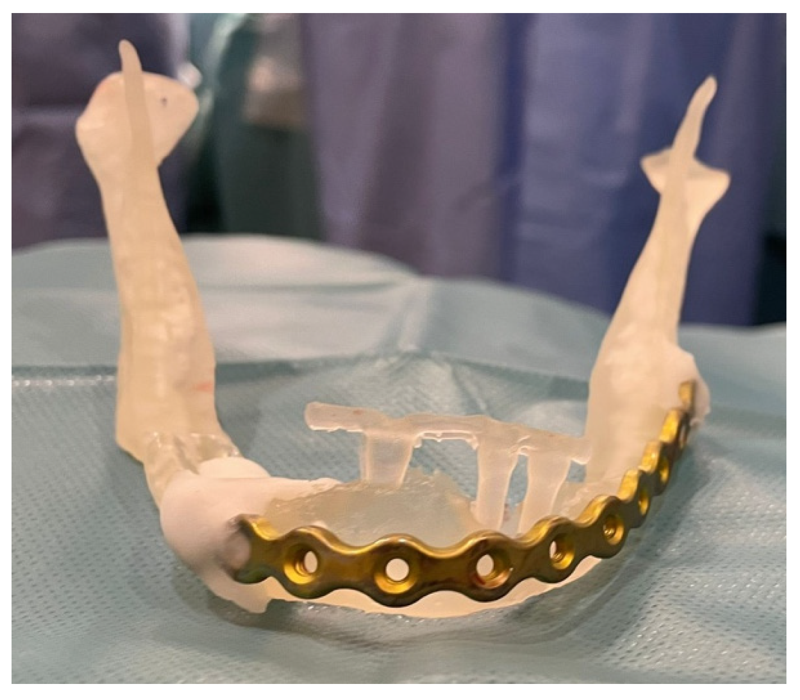 Medicina 60 01835 g005