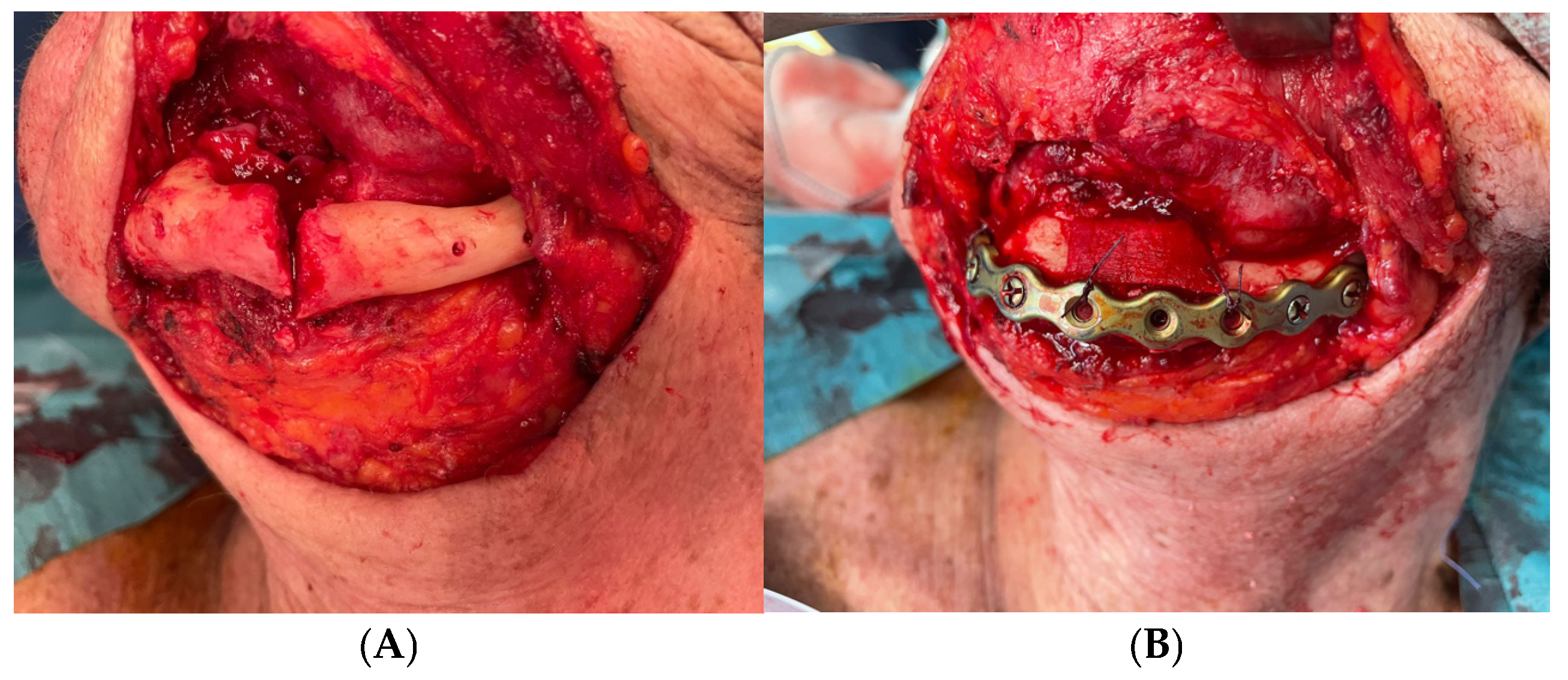 Medicina 60 01835 g006